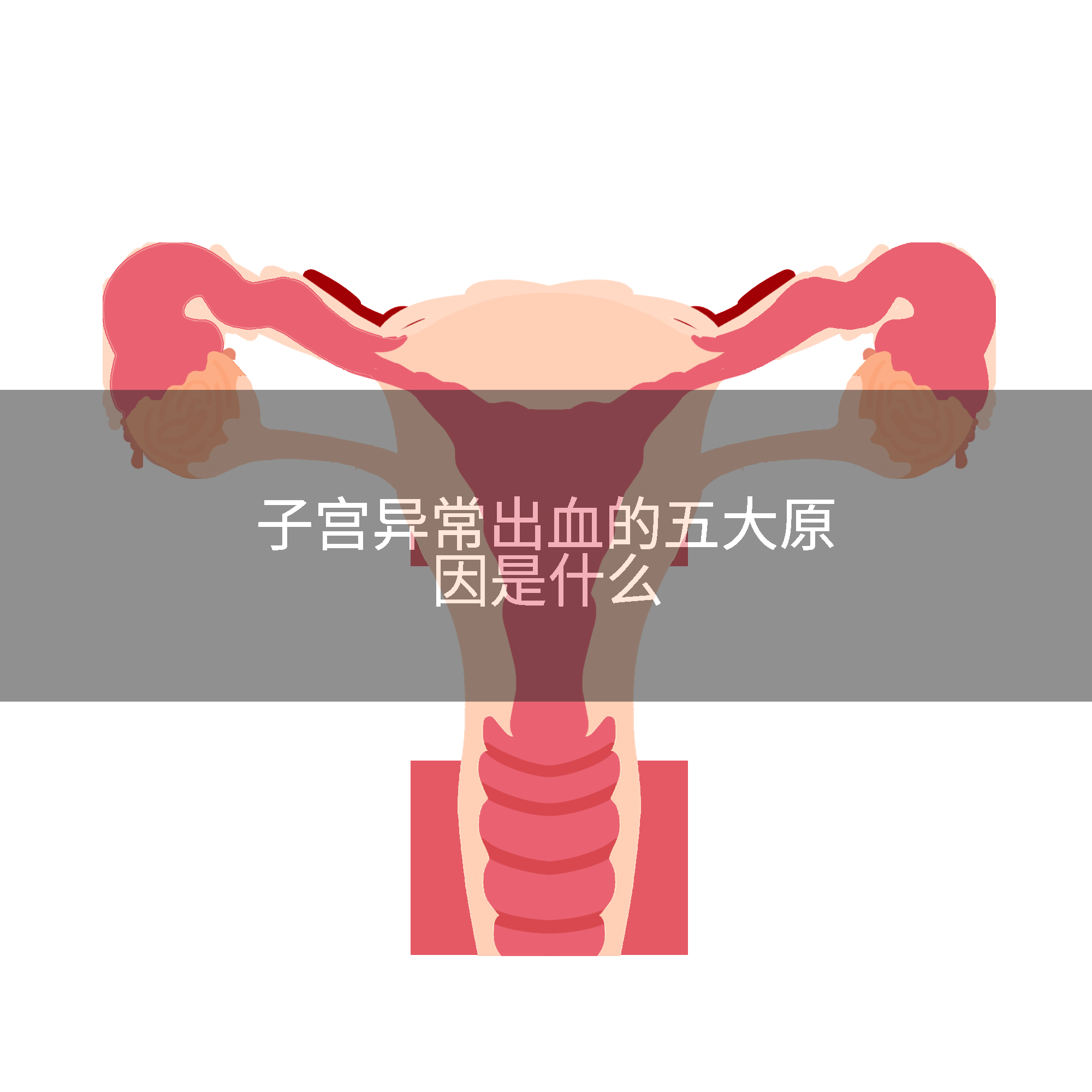 子宫异常出血的五大原因是什么