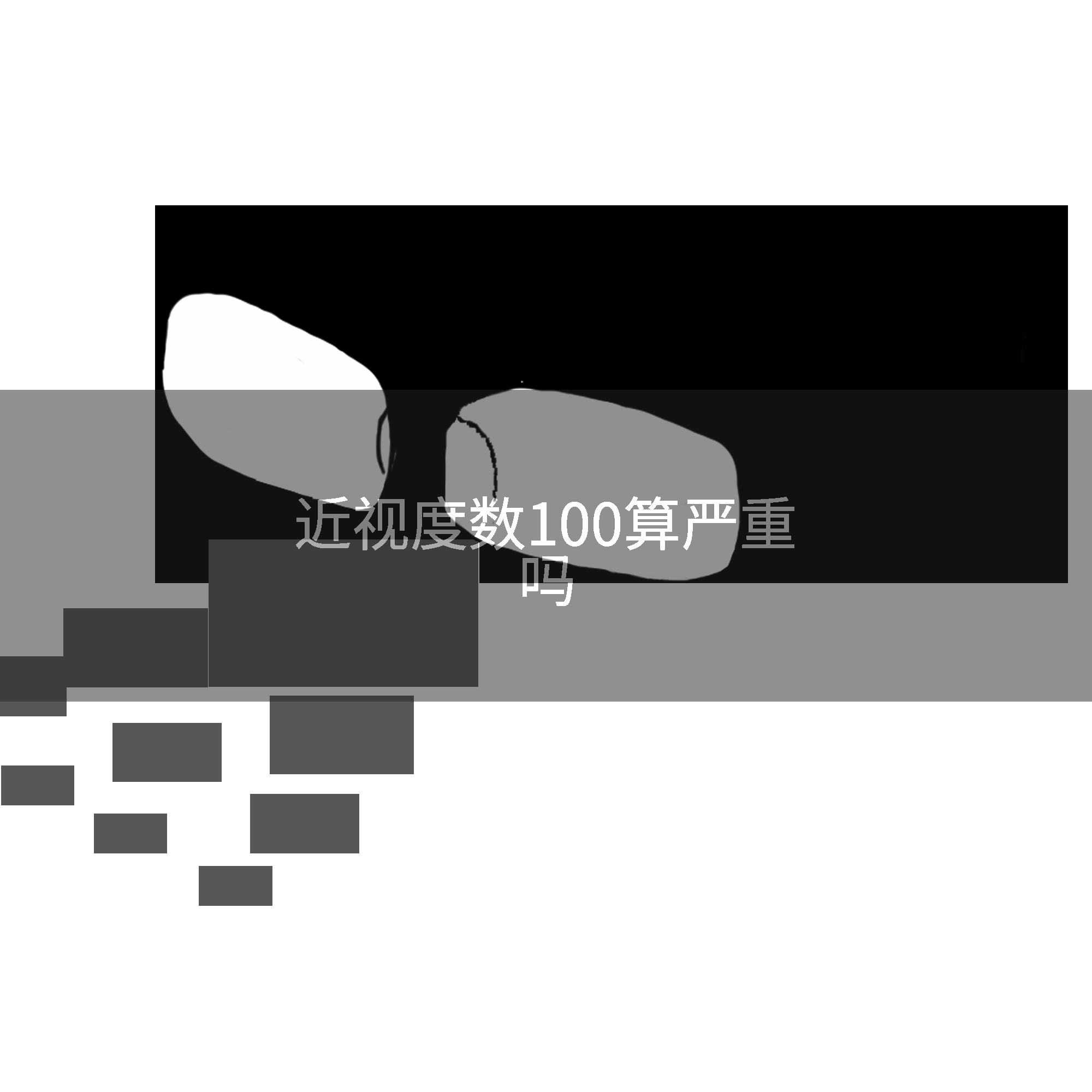 近视度数100算严重吗