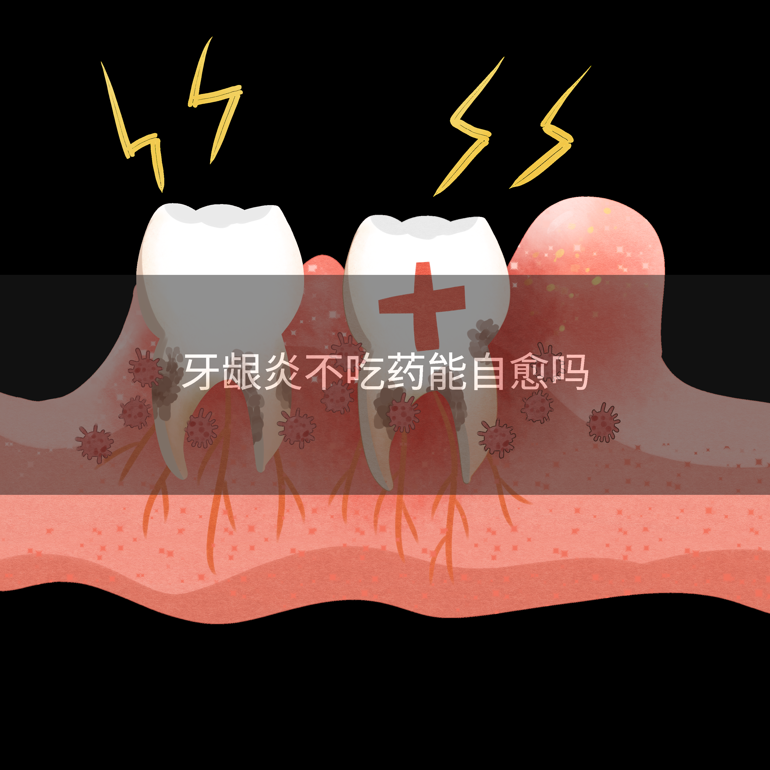 牙龈炎不吃药能自愈吗