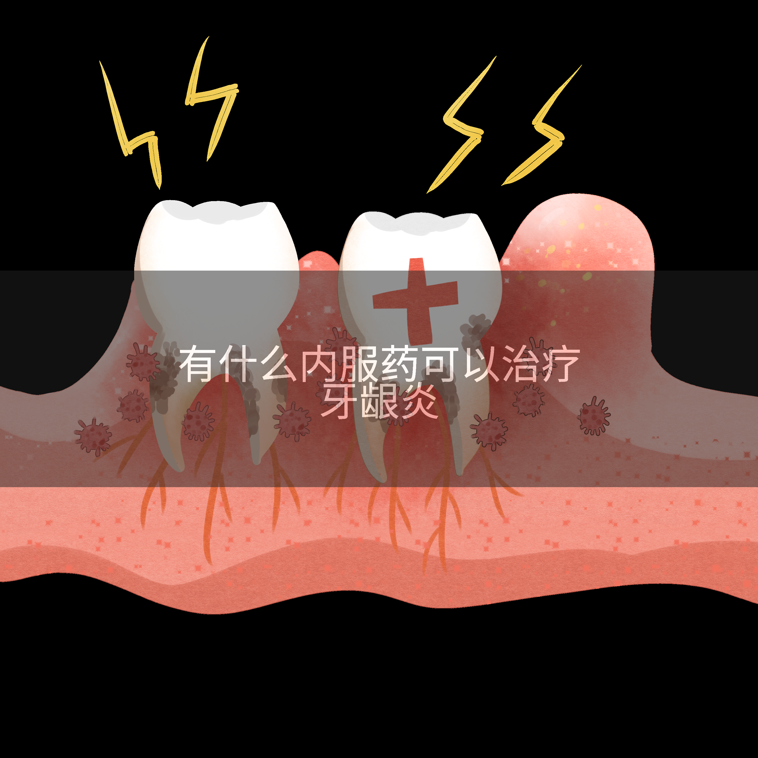 有什么内服药可以治疗牙龈炎