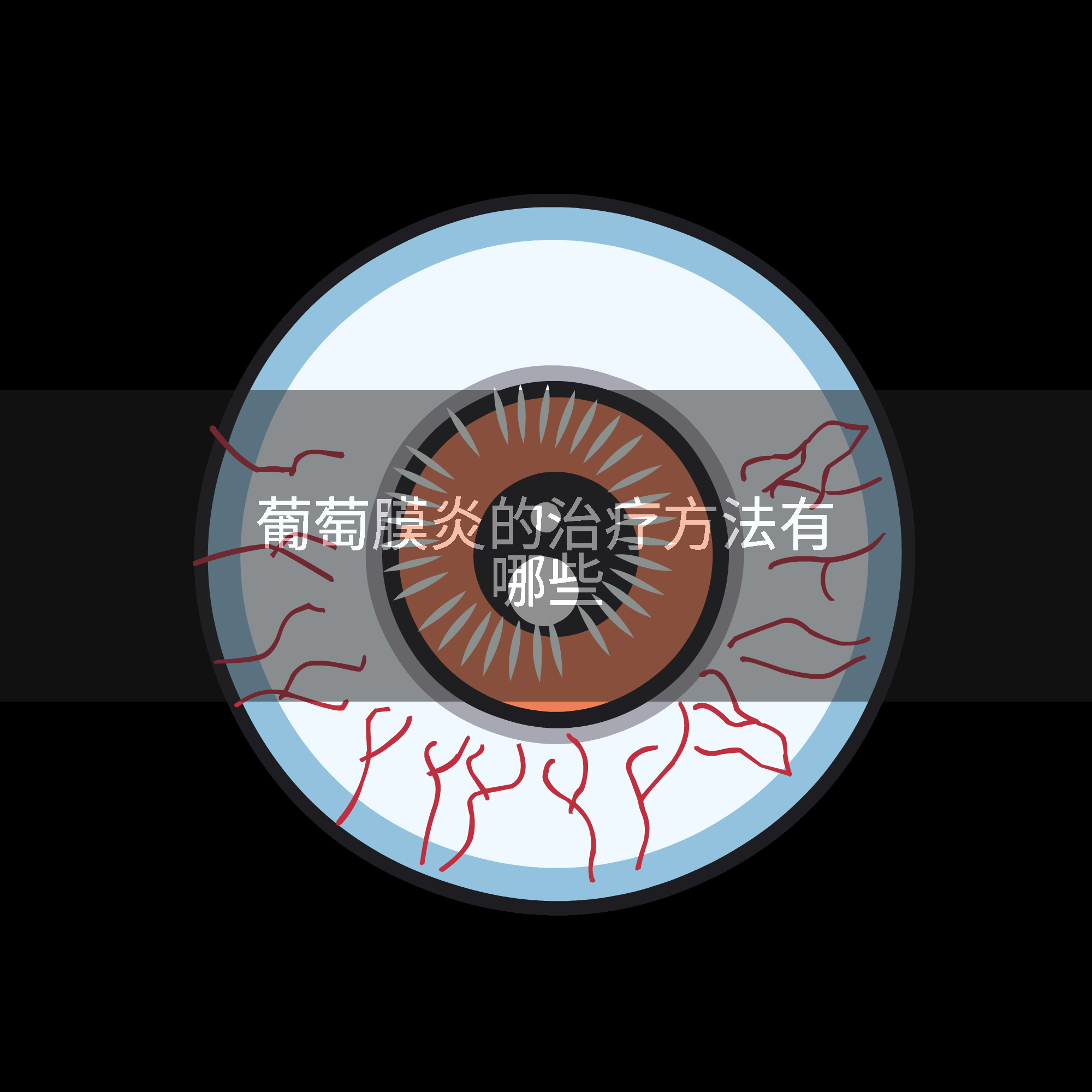 葡萄膜炎的治疗方法有哪些