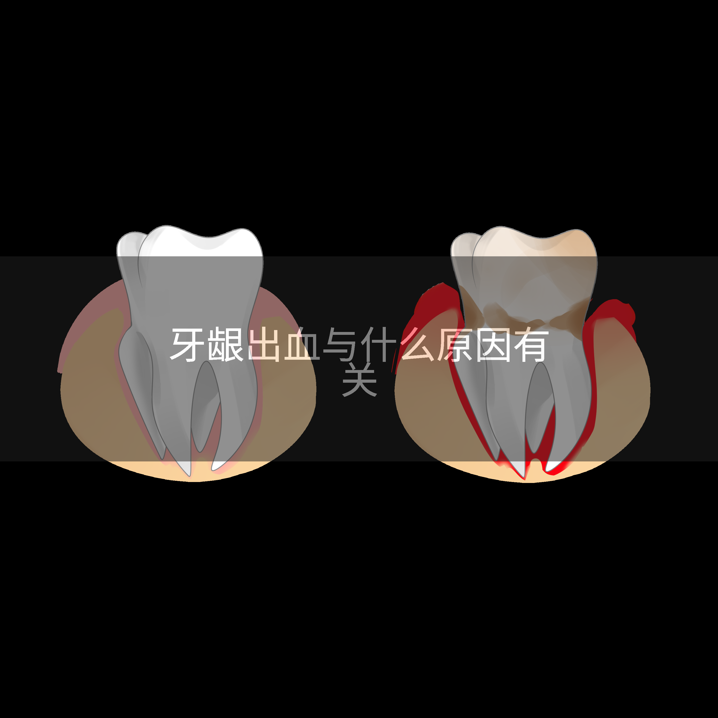 牙龈出血与什么原因有关