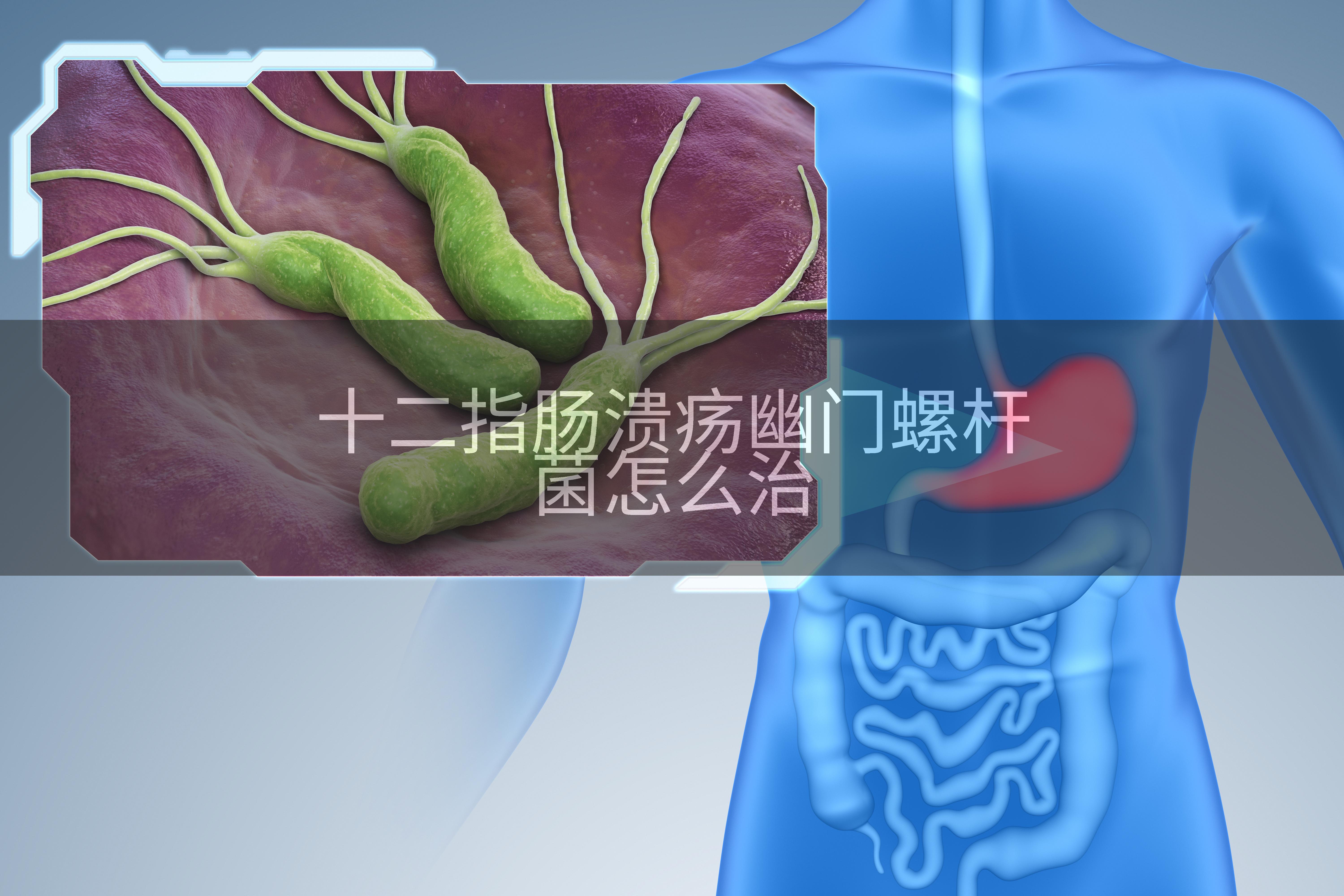 十二指肠溃疡幽门螺杆菌怎么治