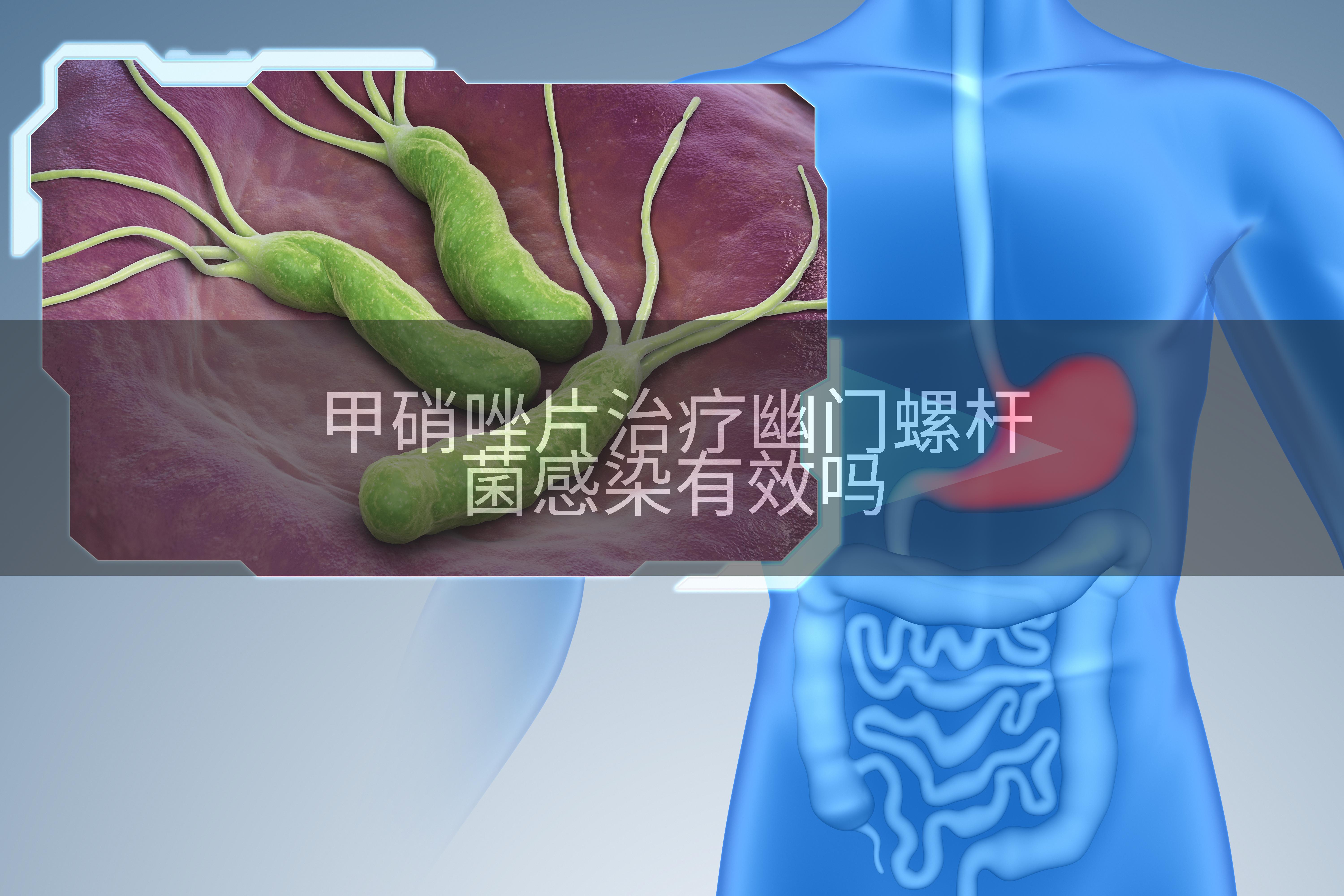 甲硝唑片治疗幽门螺杆菌感染有效吗