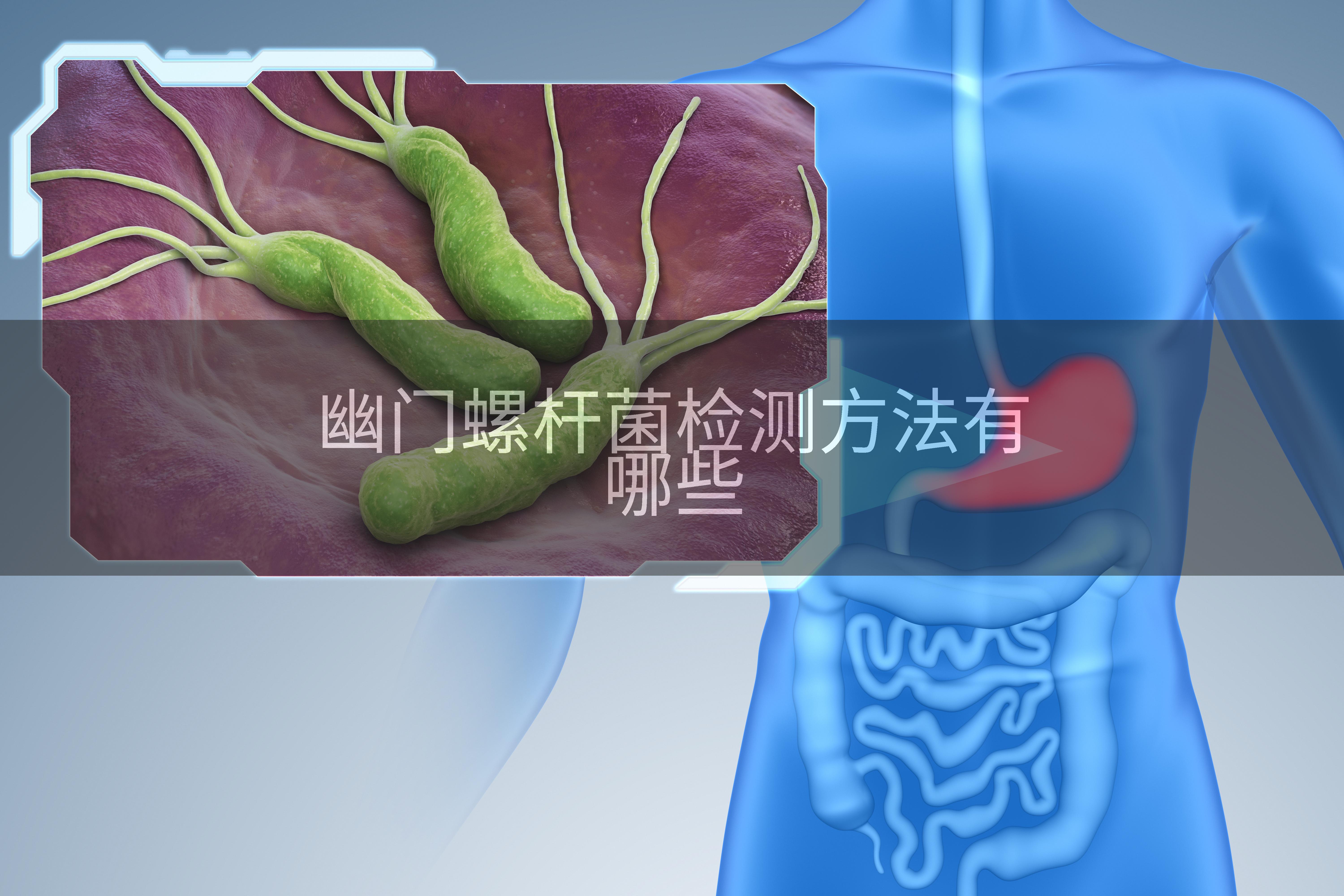 幽门螺杆菌检测方法有哪些