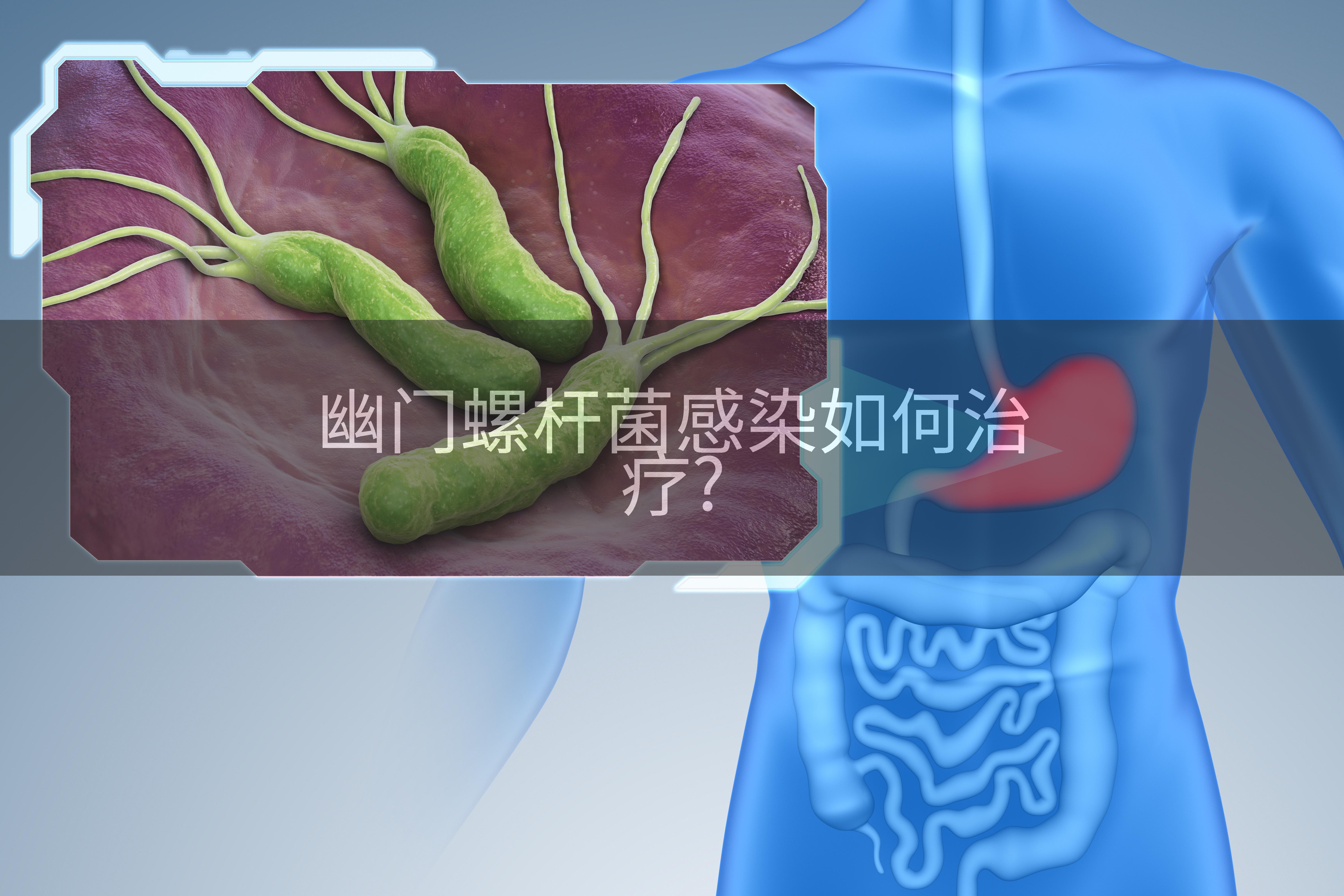 幽门螺杆菌感染如何治疗?