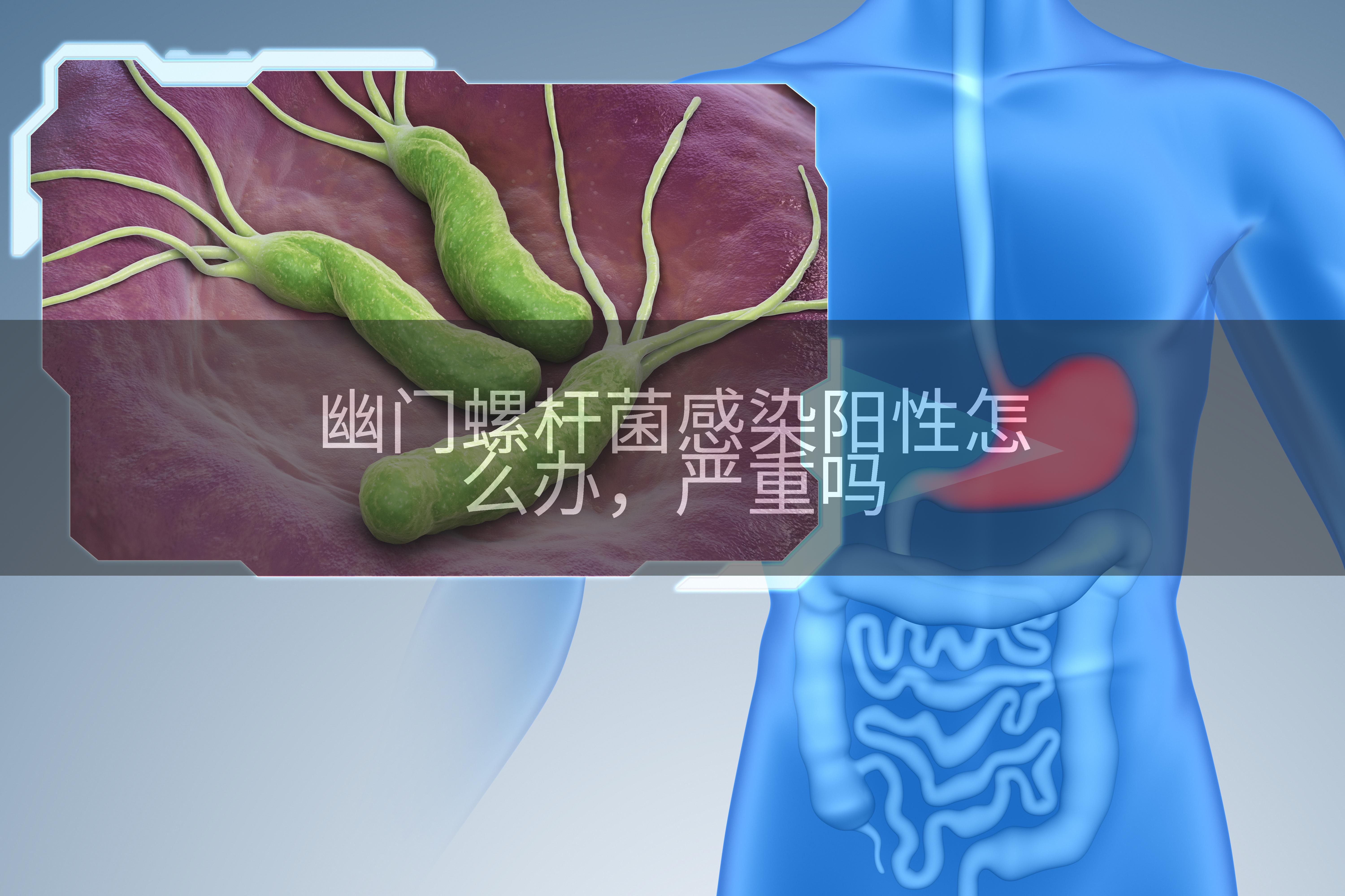 幽门螺杆菌感染阳性怎么办，严重吗