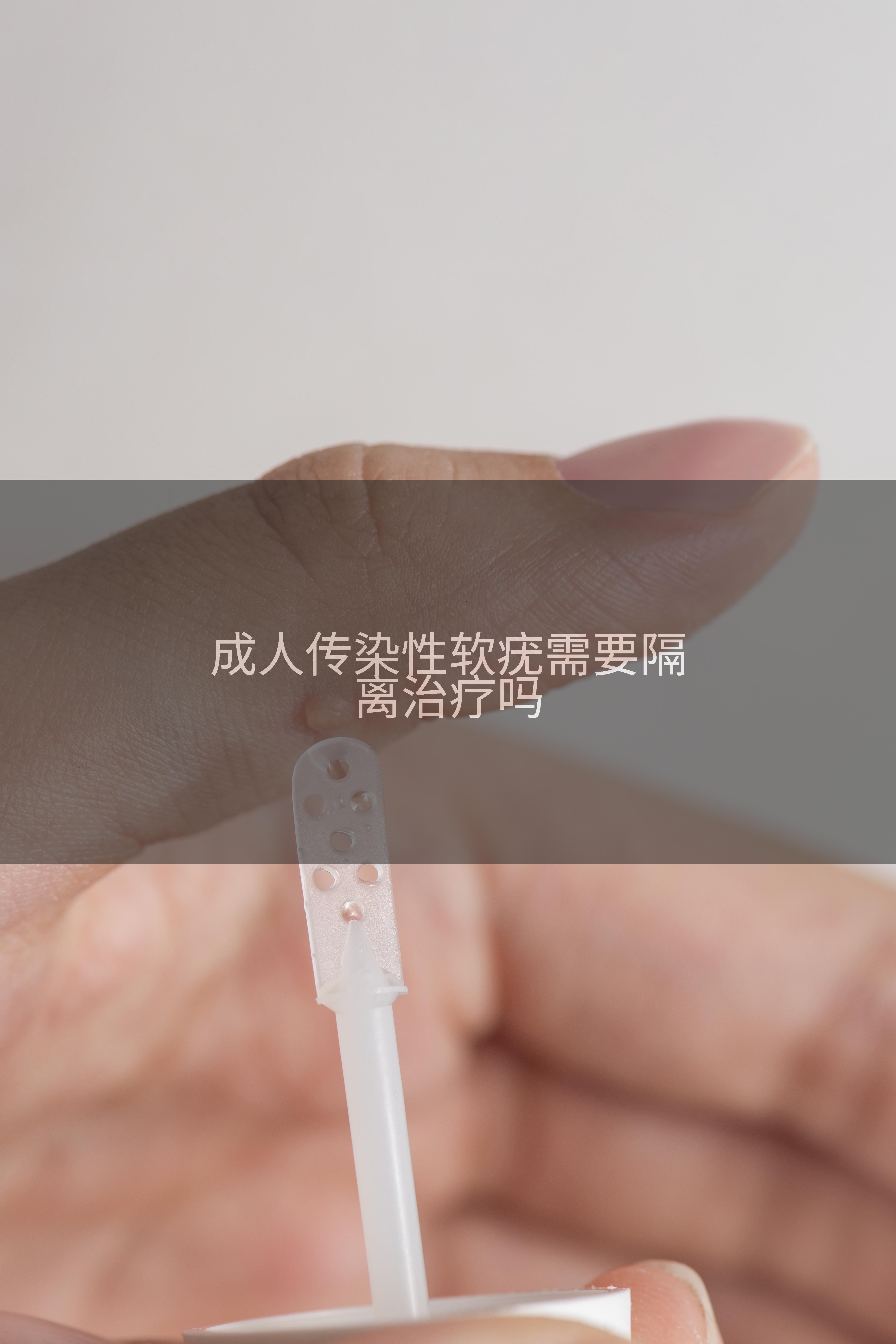 成人传染性软疣需要隔离治疗吗