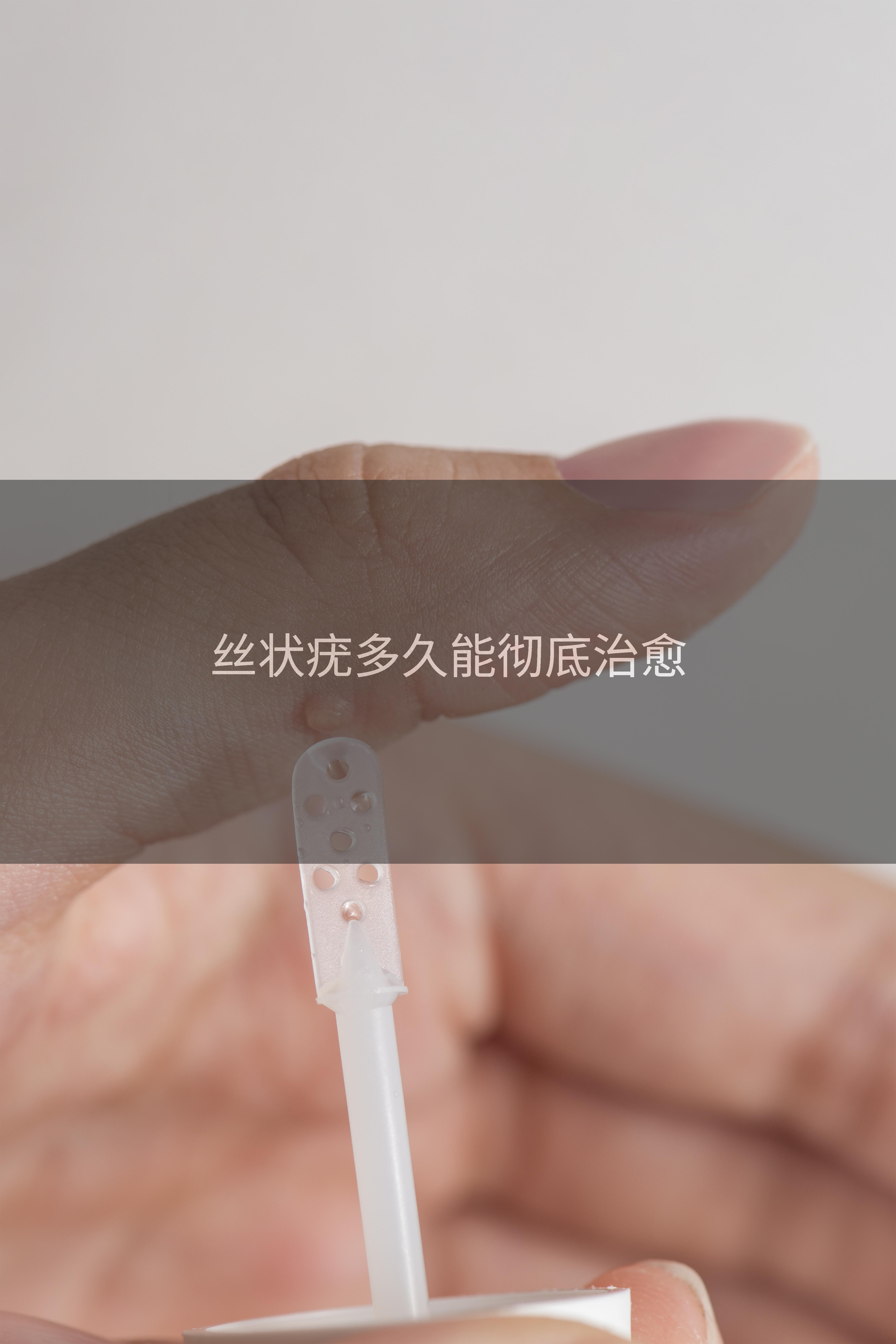 丝状疣多久能彻底治愈