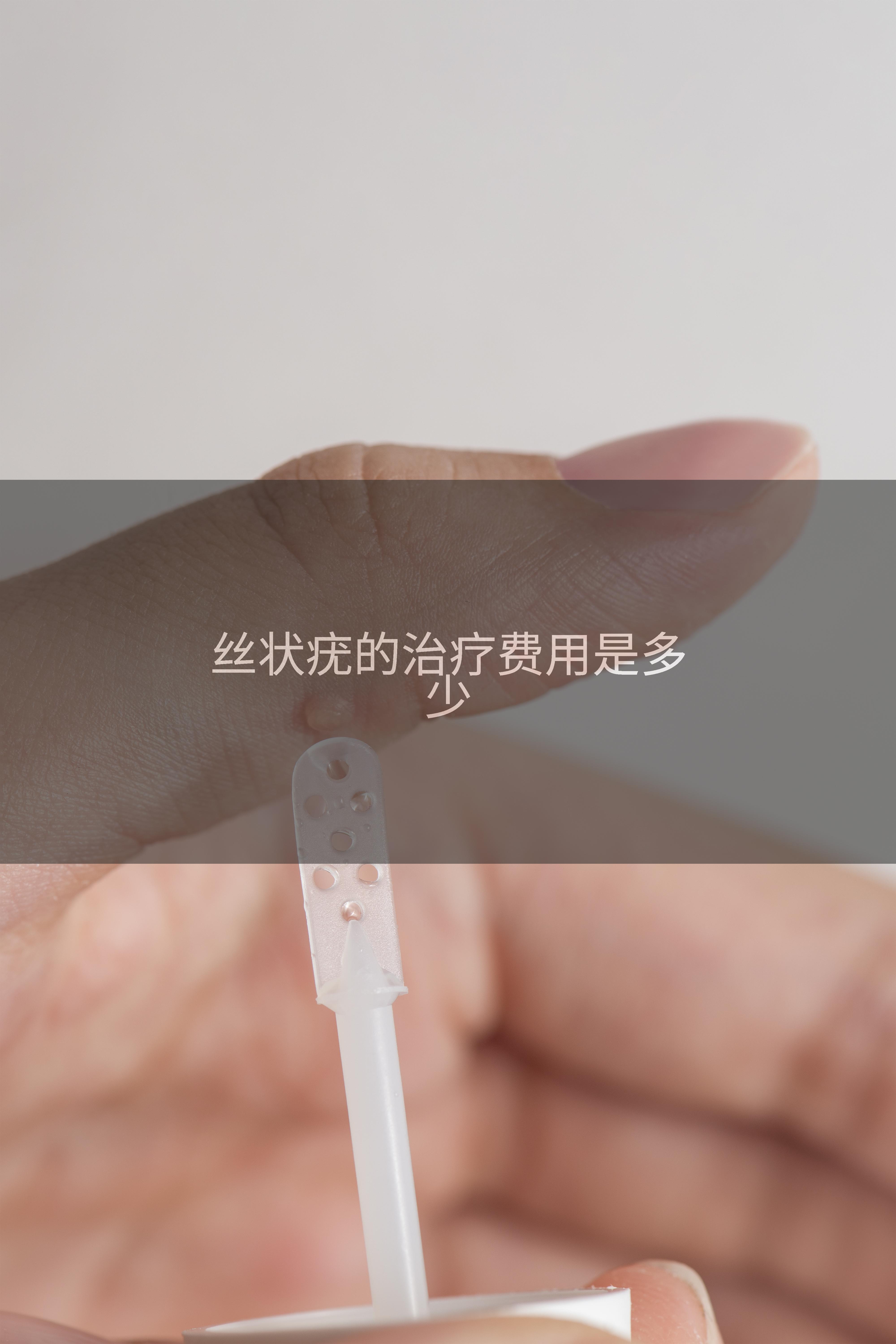 丝状疣的治疗费用是多少