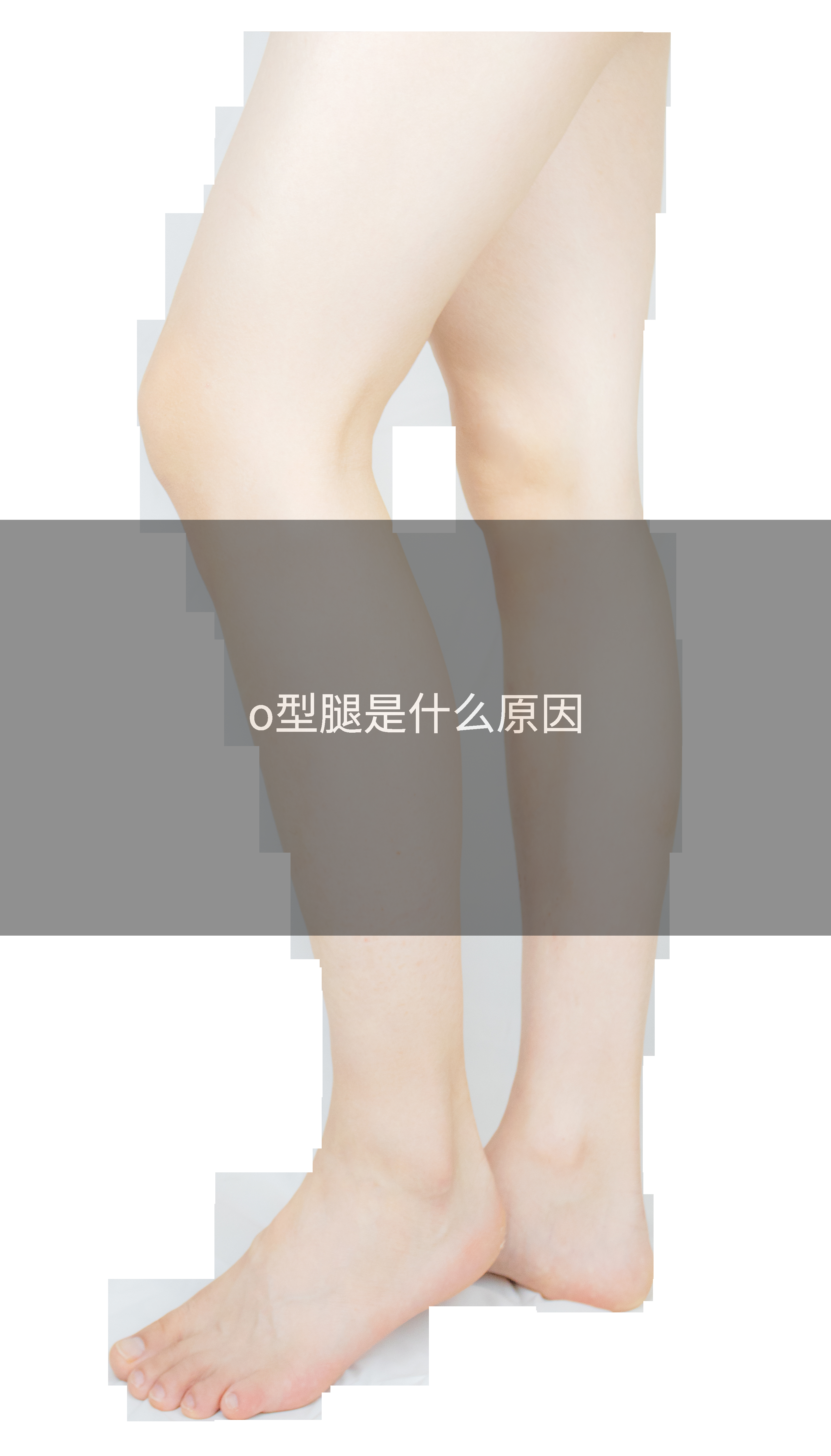 o型腿是什么原因