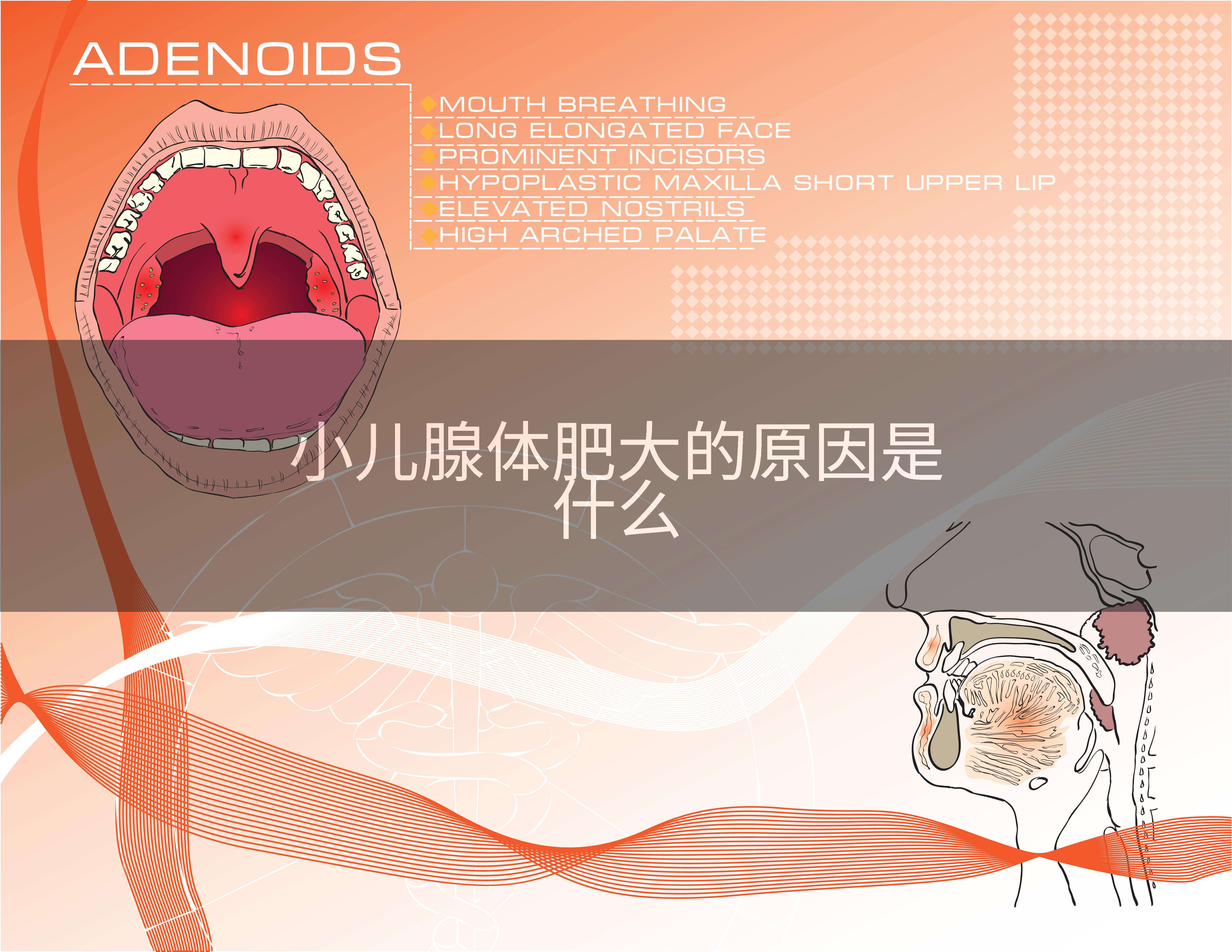小儿腺体肥大的原因是什么