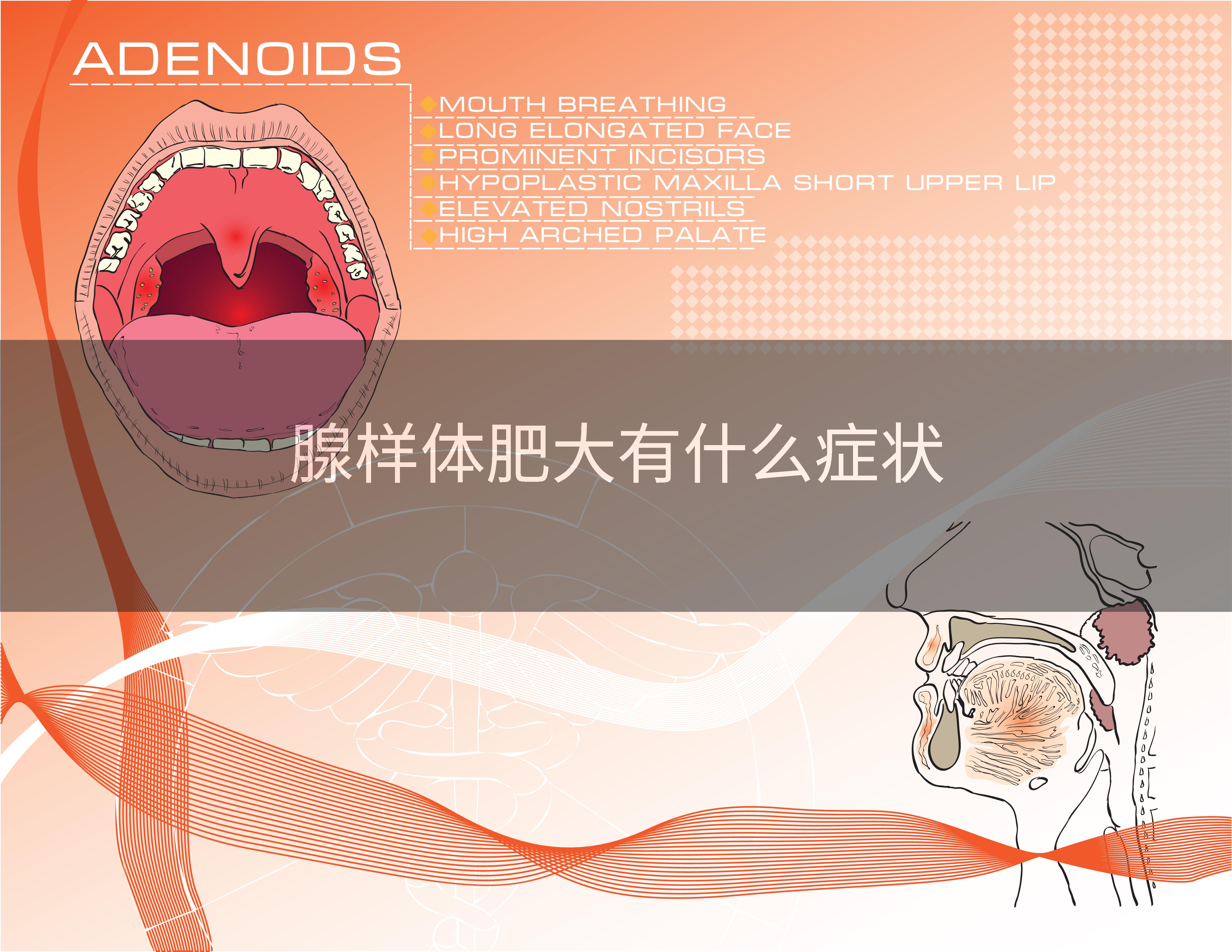 腺样体肥大有什么症状