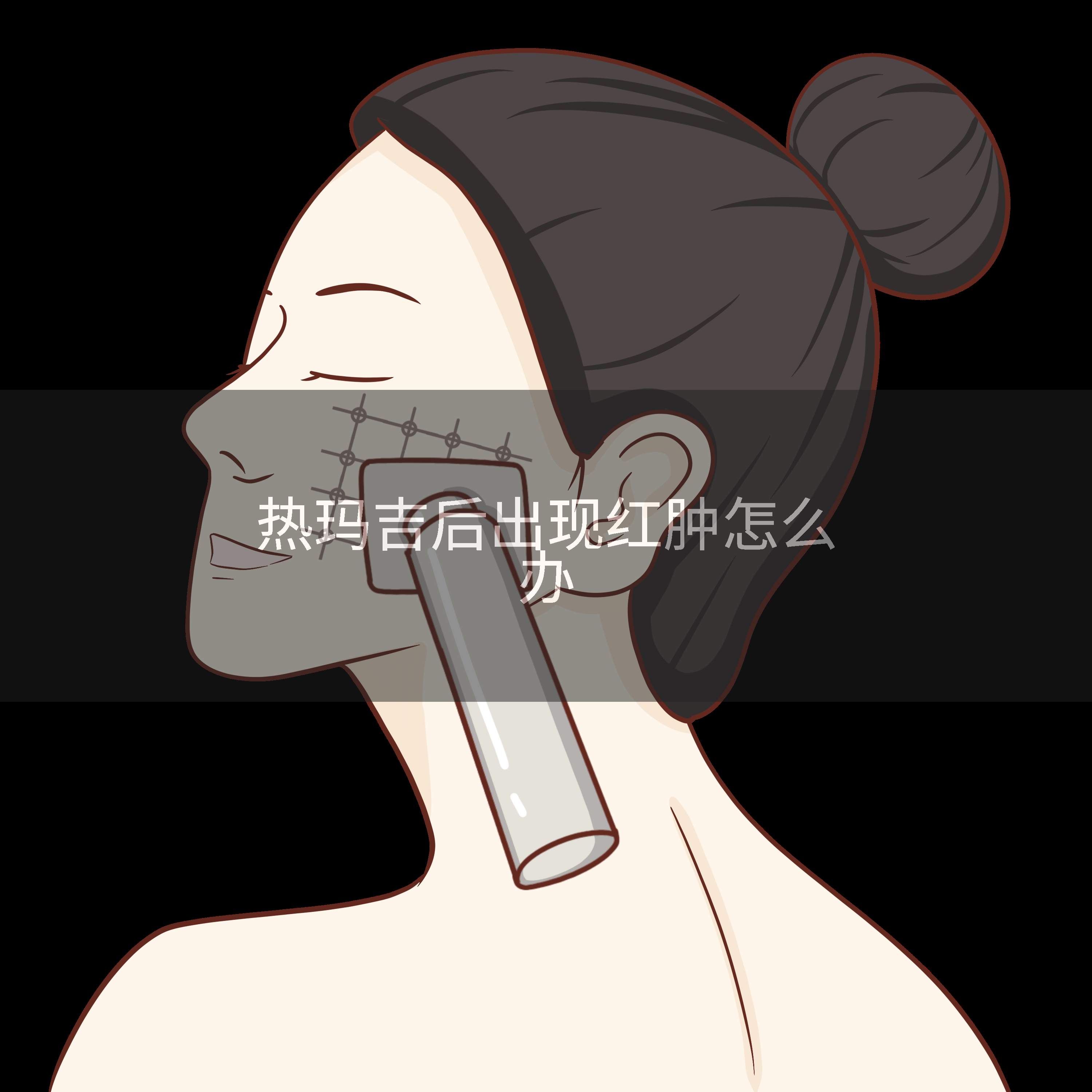 热玛吉后出现红肿怎么办