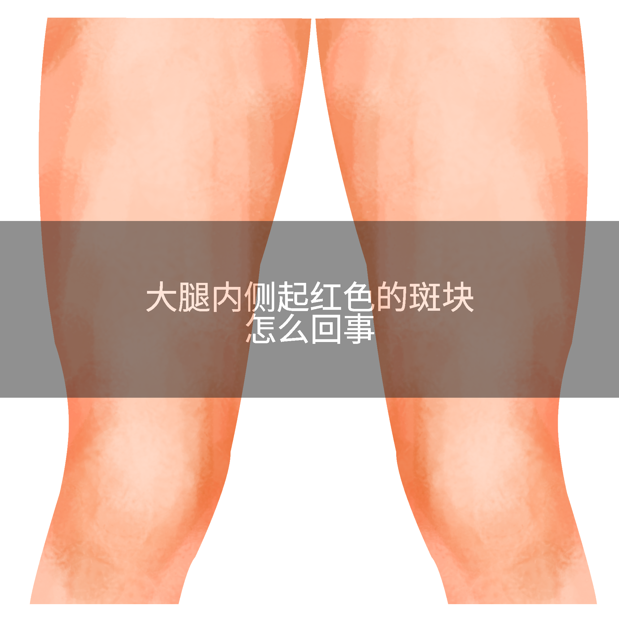 大腿内侧起红色的斑块怎么回事