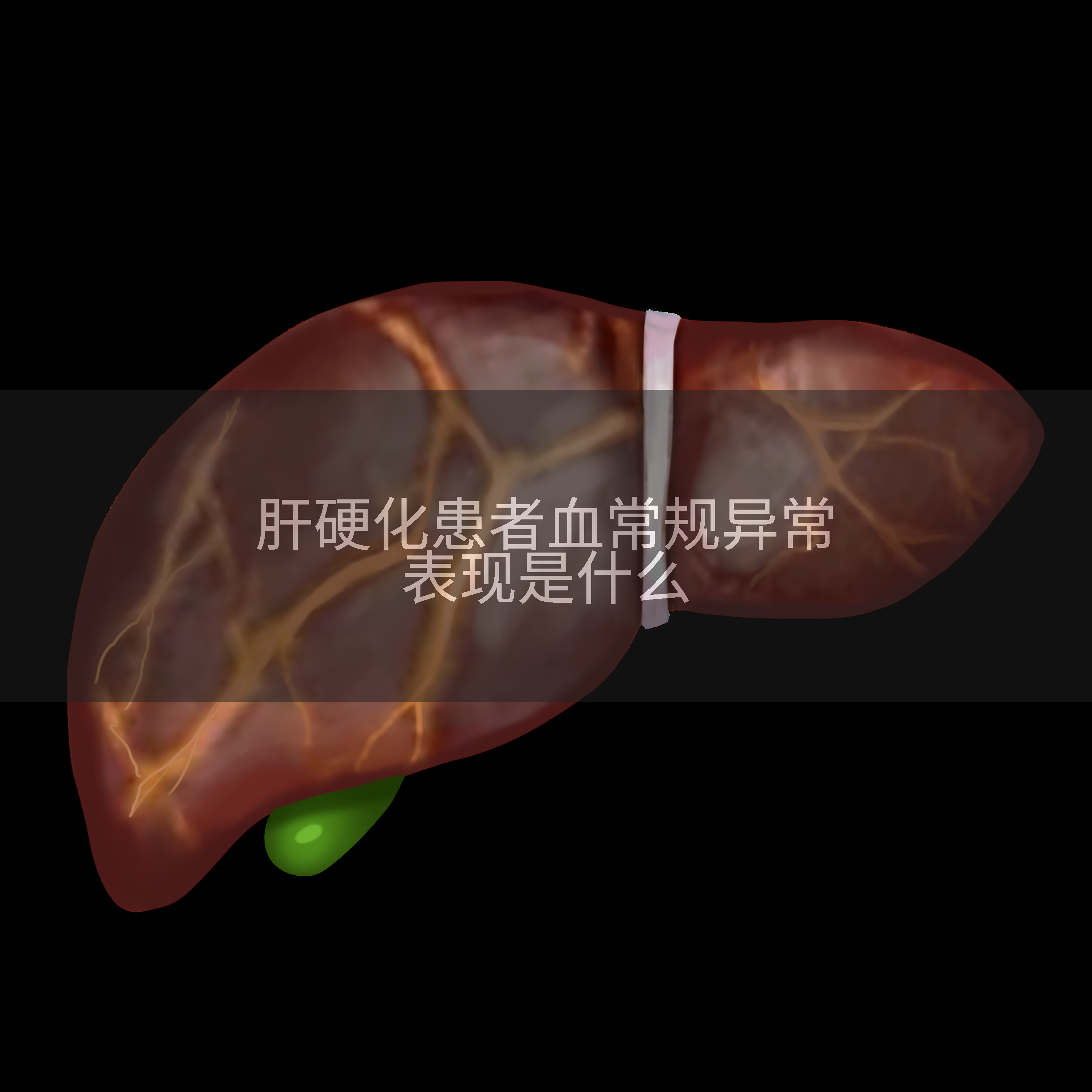 肝硬化患者血常规异常表现是什么