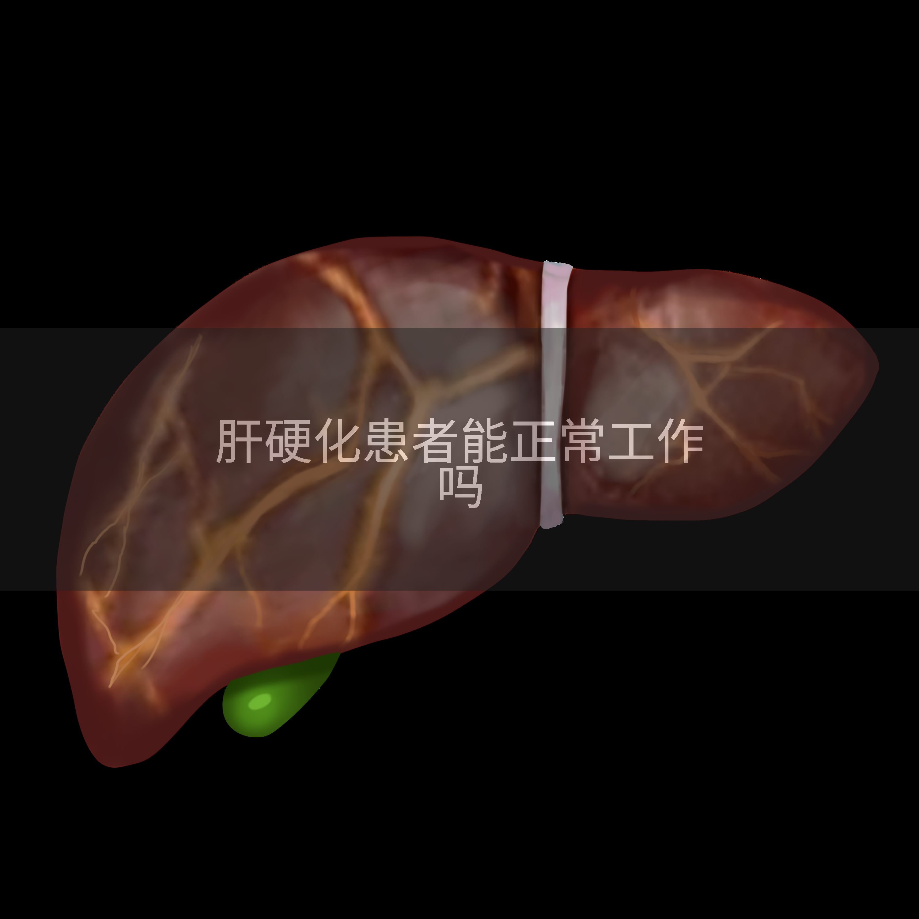 肝硬化患者能正常工作吗