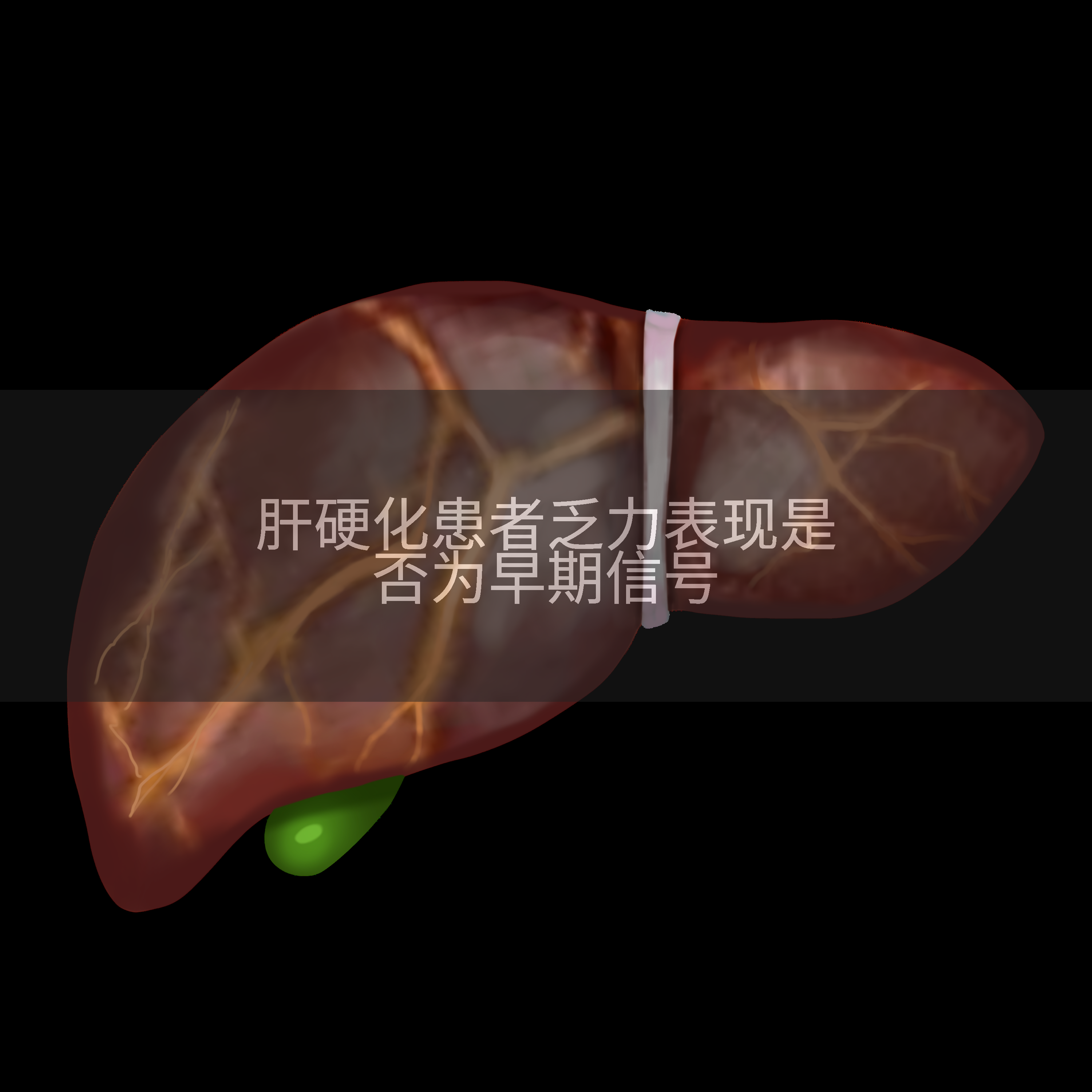 肝硬化患者乏力表现是否为早期信号