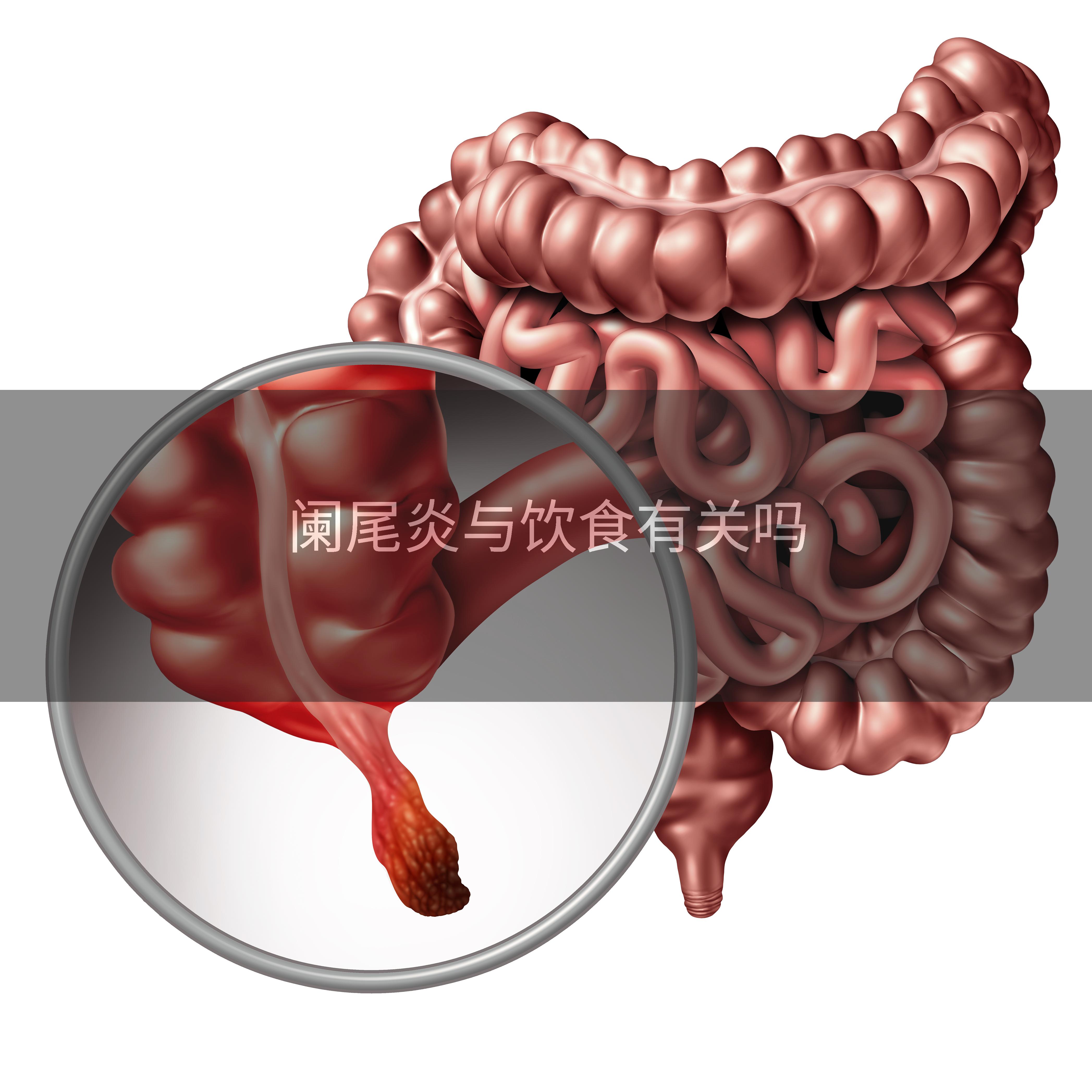 阑尾炎与饮食有关吗
