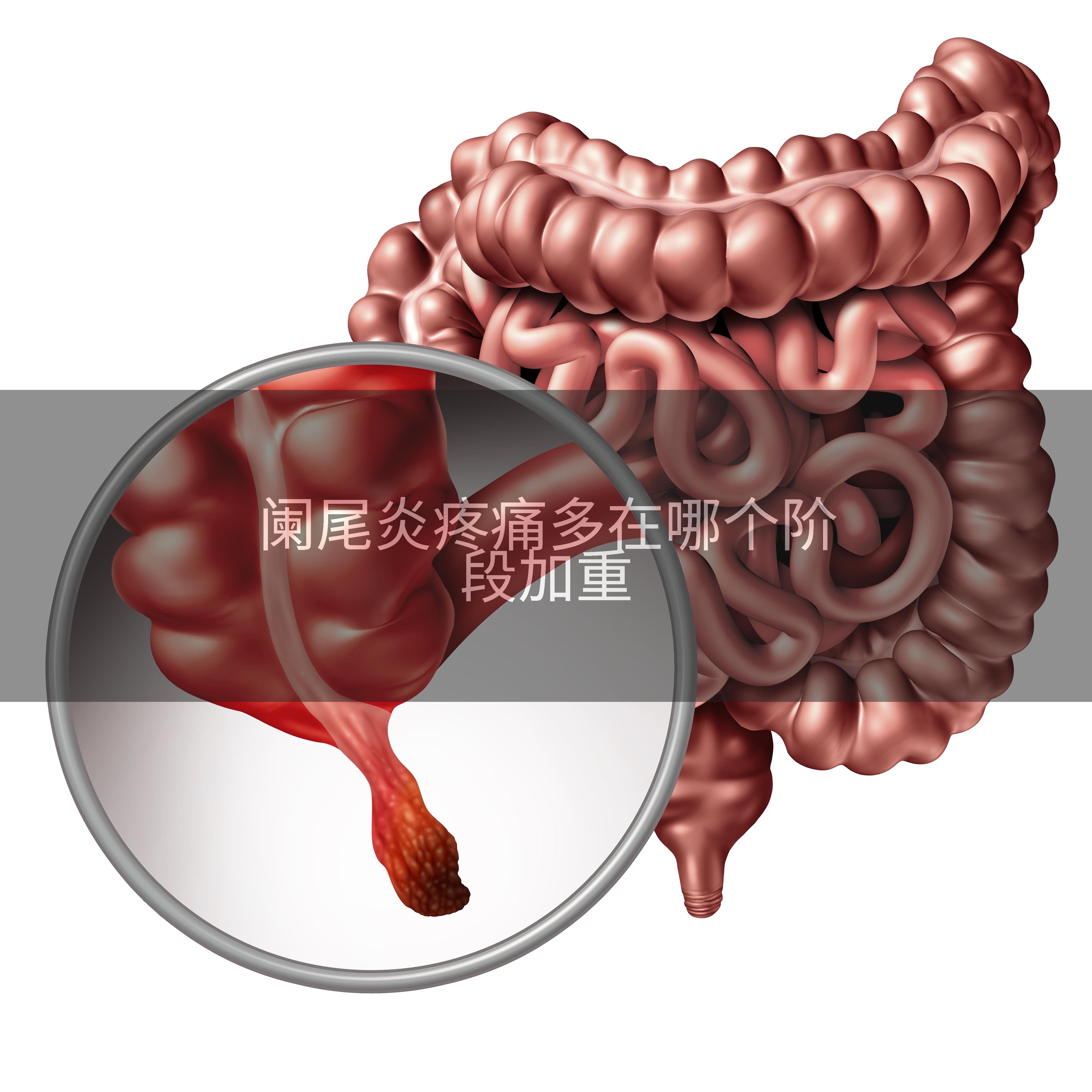 阑尾炎疼痛多在哪个阶段加重