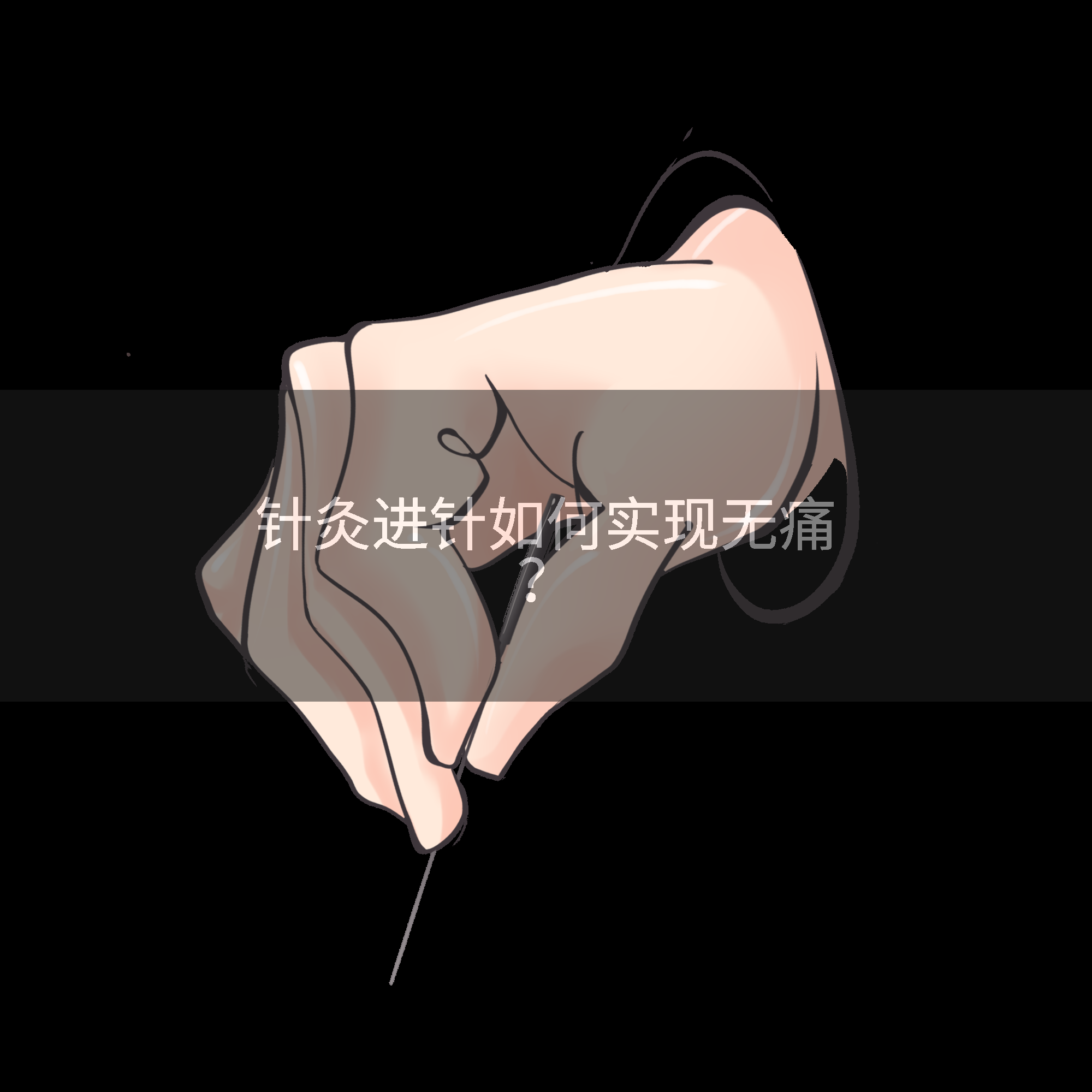 针灸进针如何实现无痛？