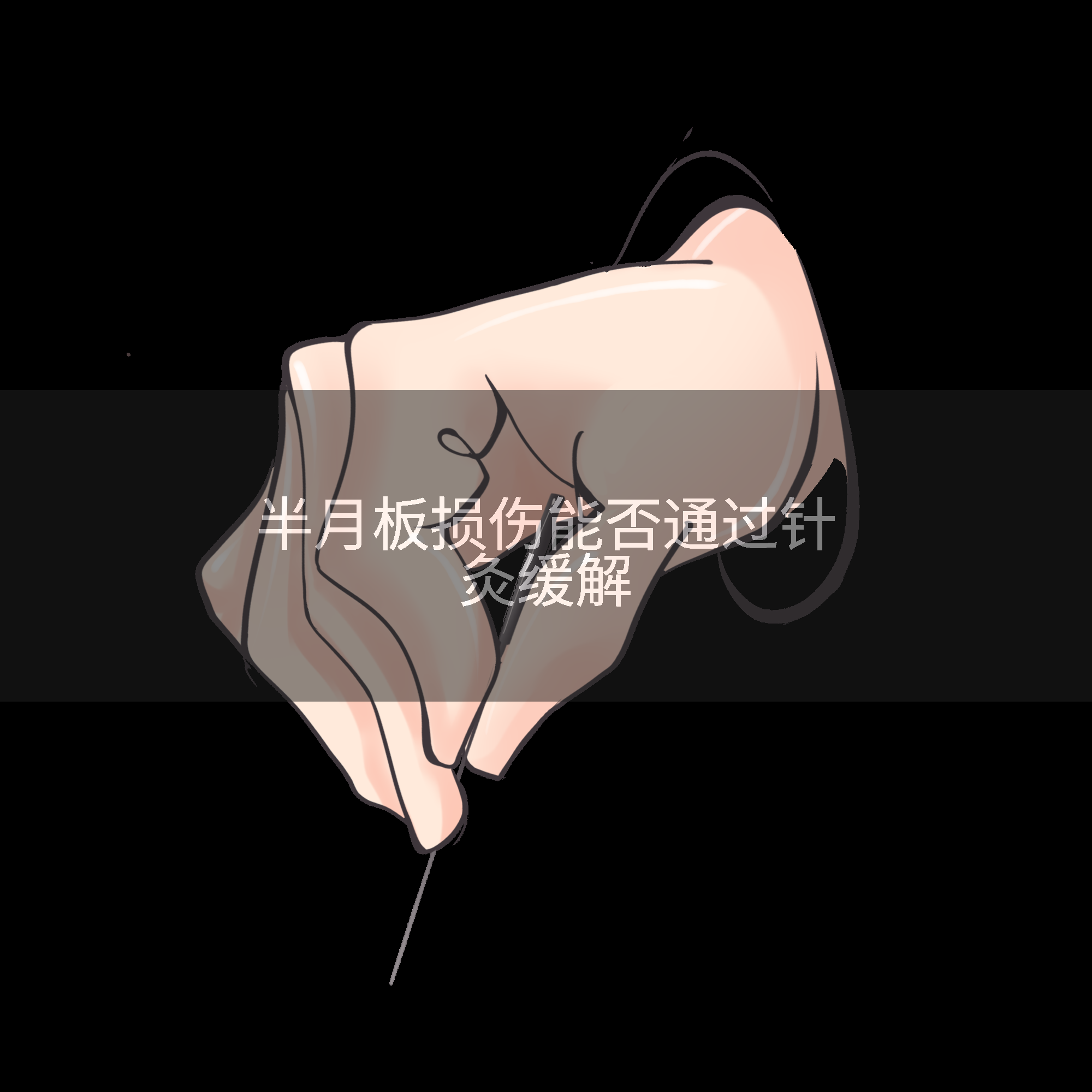 半月板损伤能否通过针灸缓解