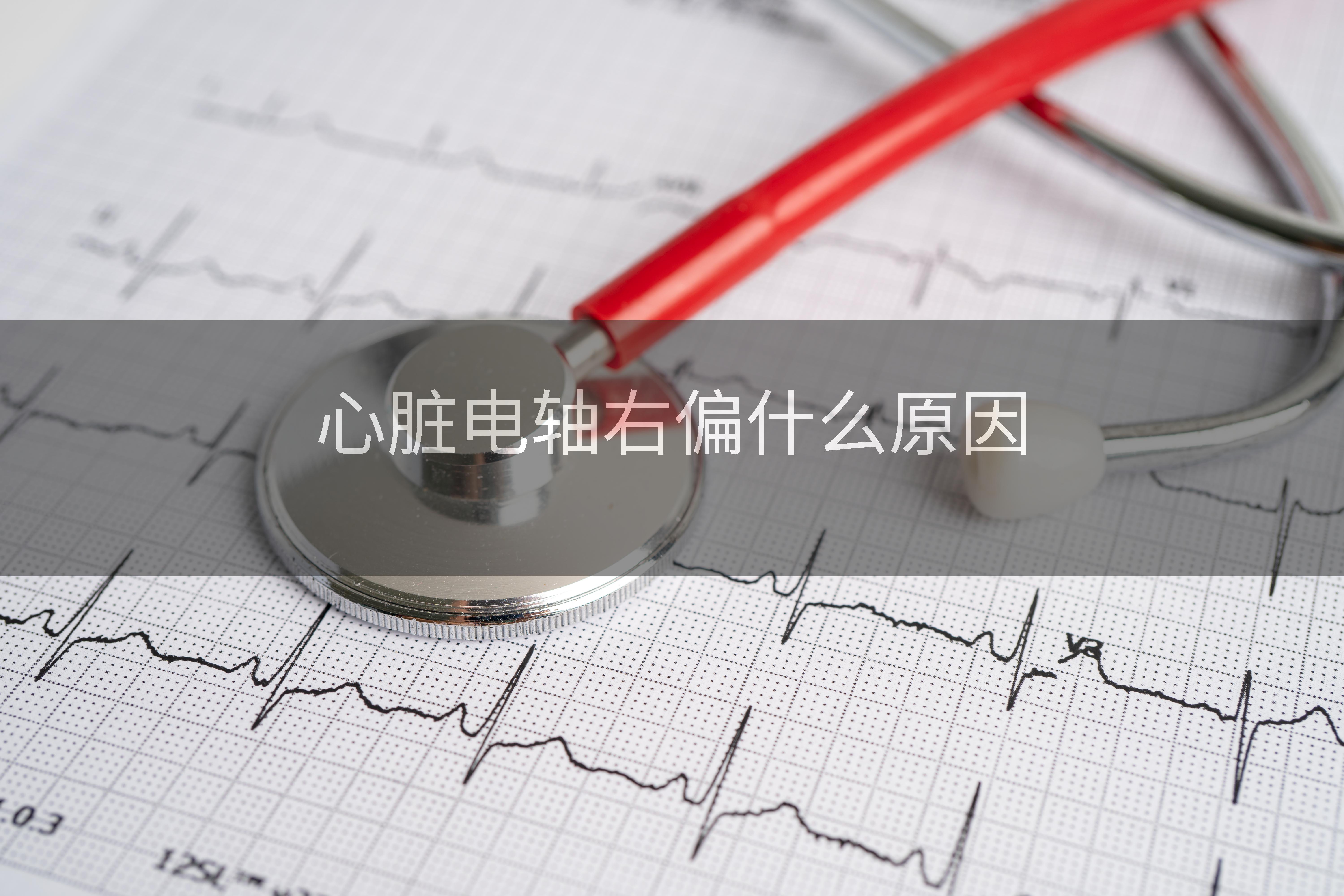 心脏电轴右偏什么原因