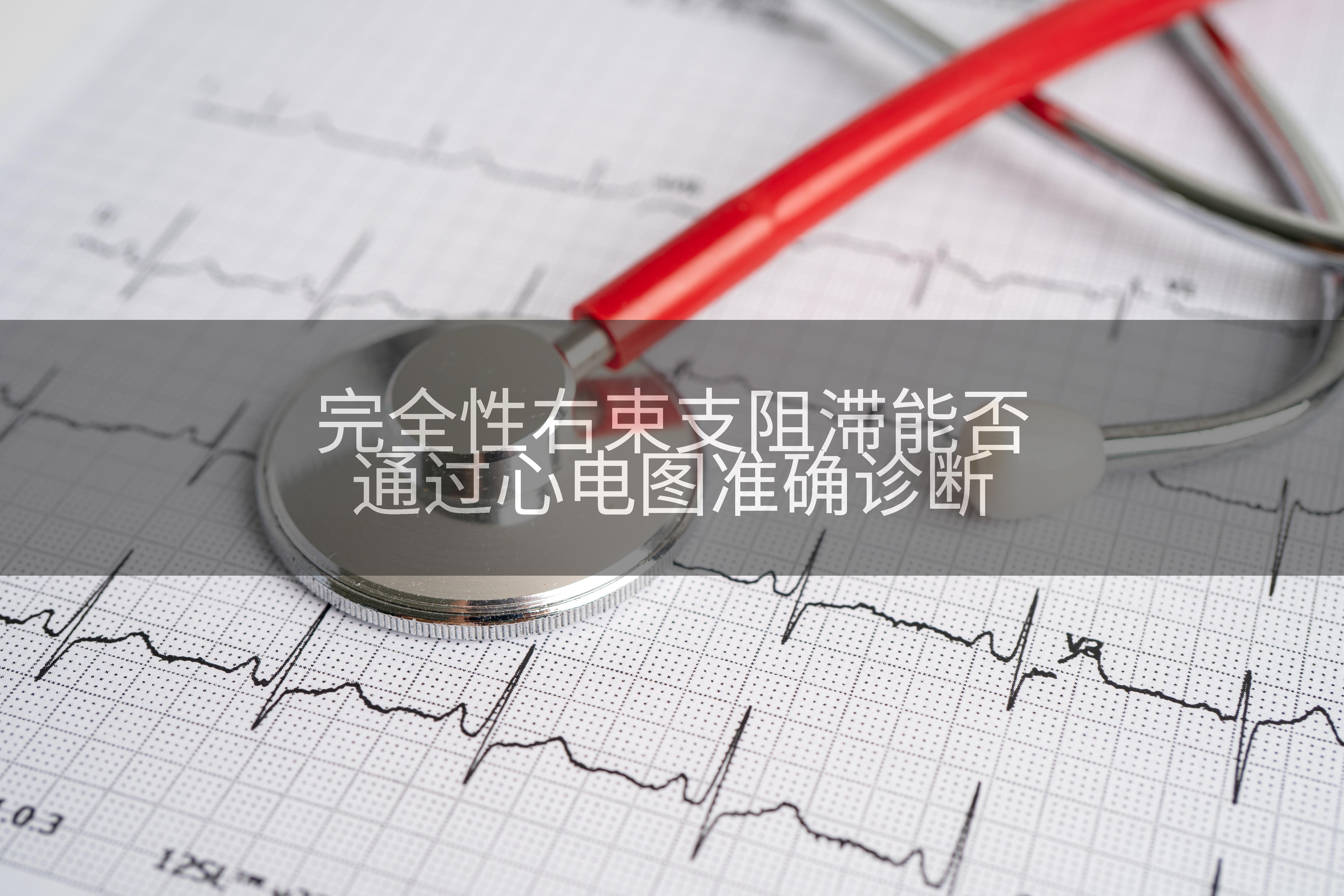 完全性右束支阻滞能否通过心电图准确诊断