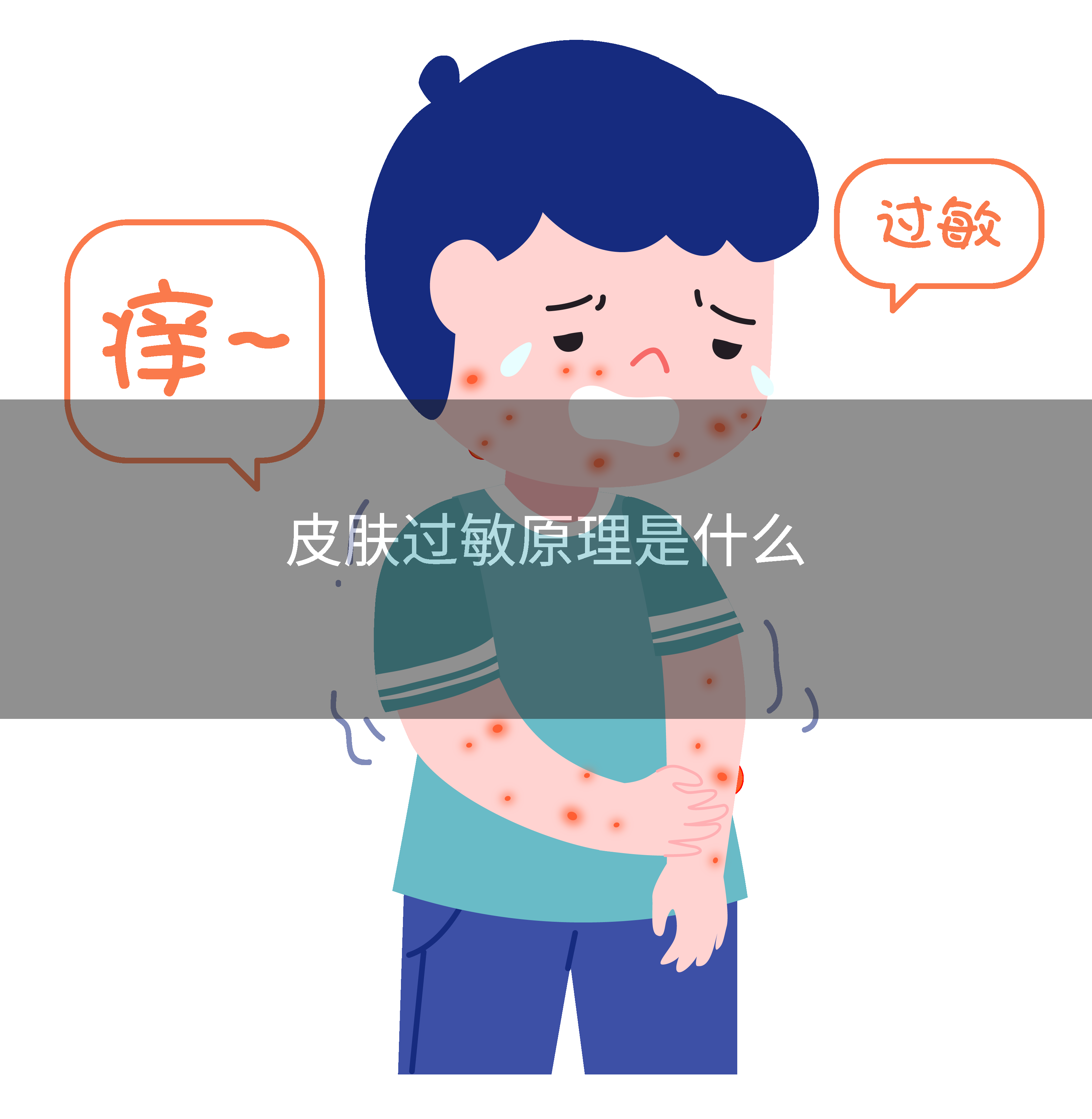 皮肤过敏原理是什么