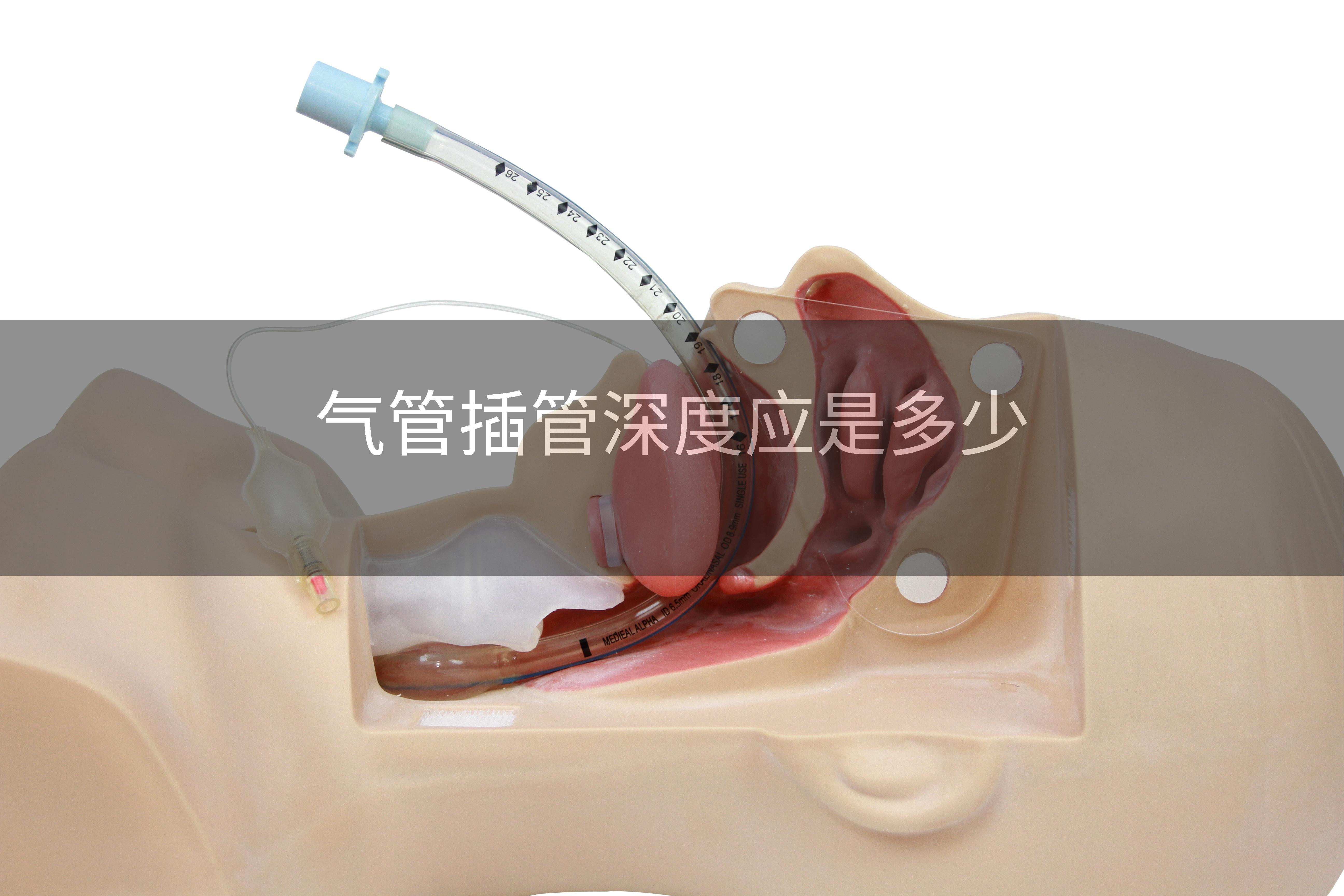 气管插管深度应是多少