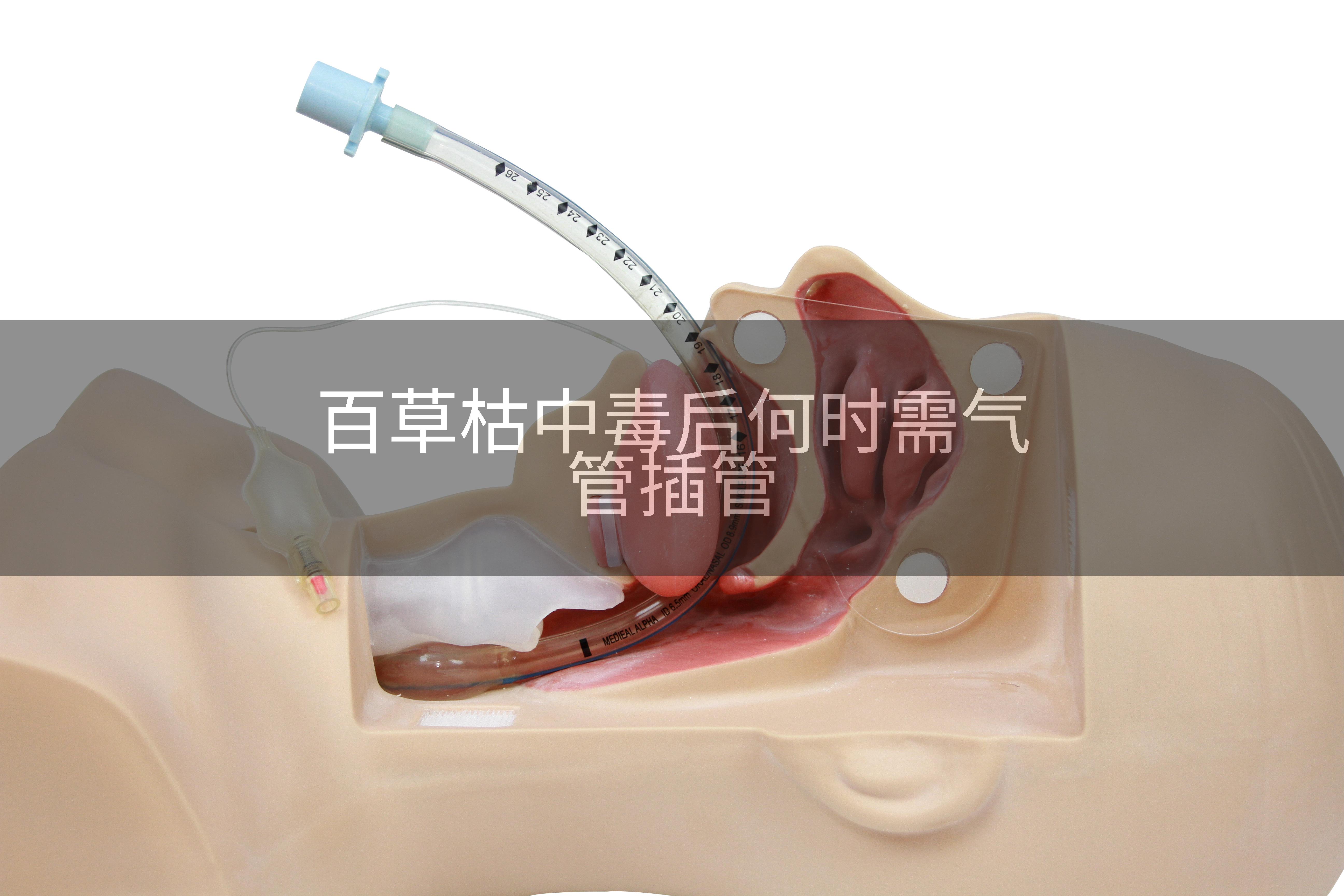 百草枯中毒后何时需气管插管
