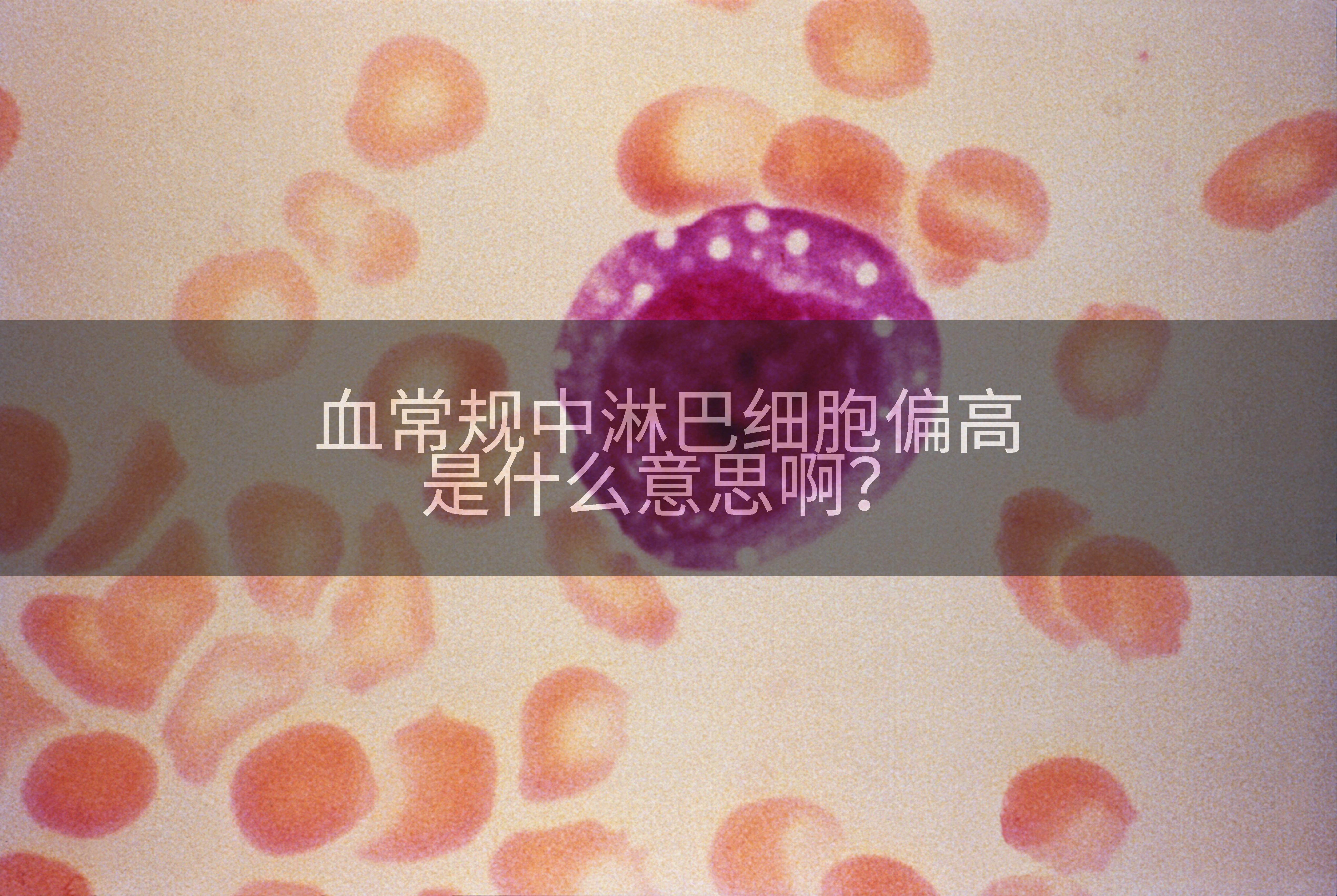 血常规中淋巴细胞偏高是什么意思啊？