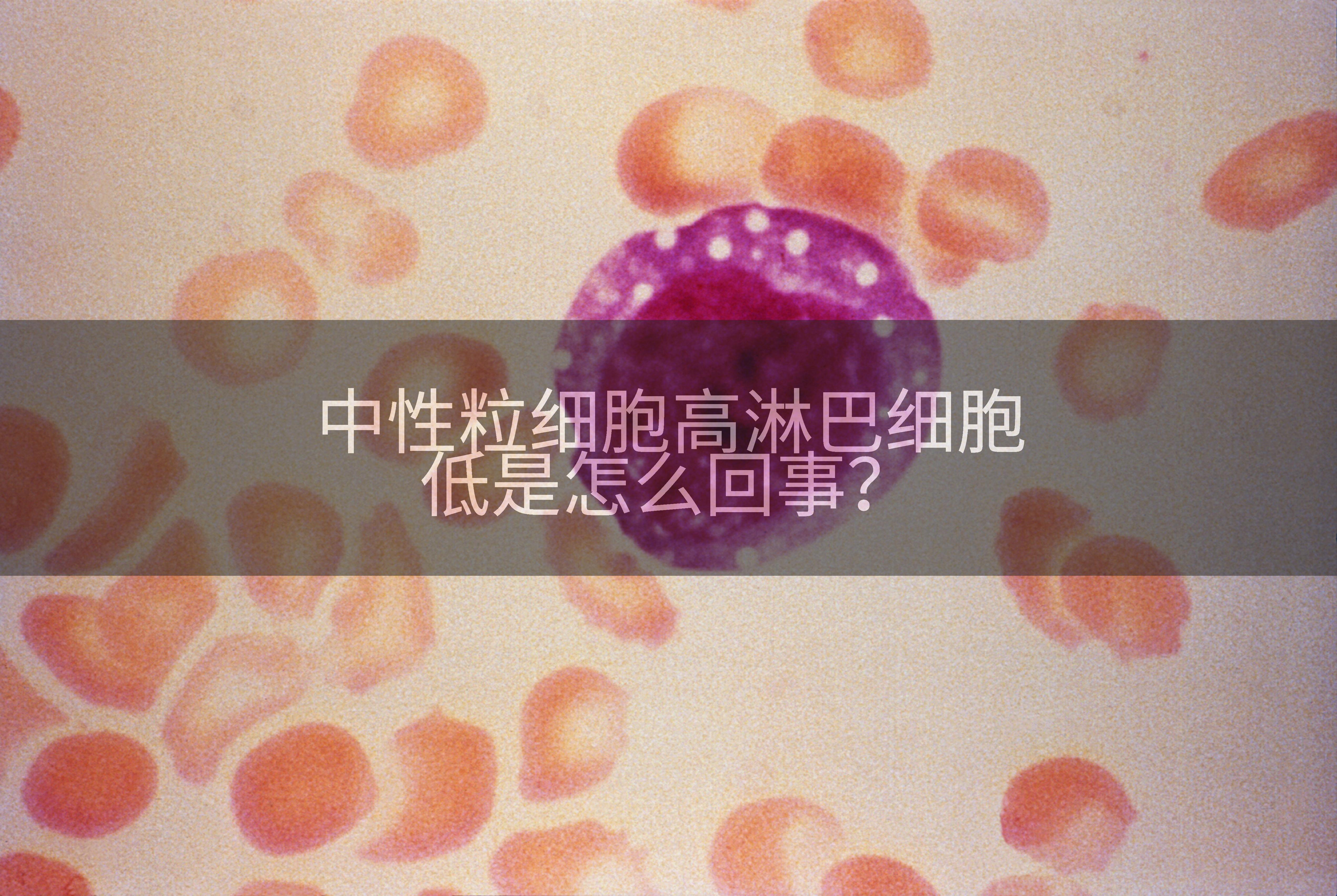 中性粒细胞高淋巴细胞低是怎么回事？