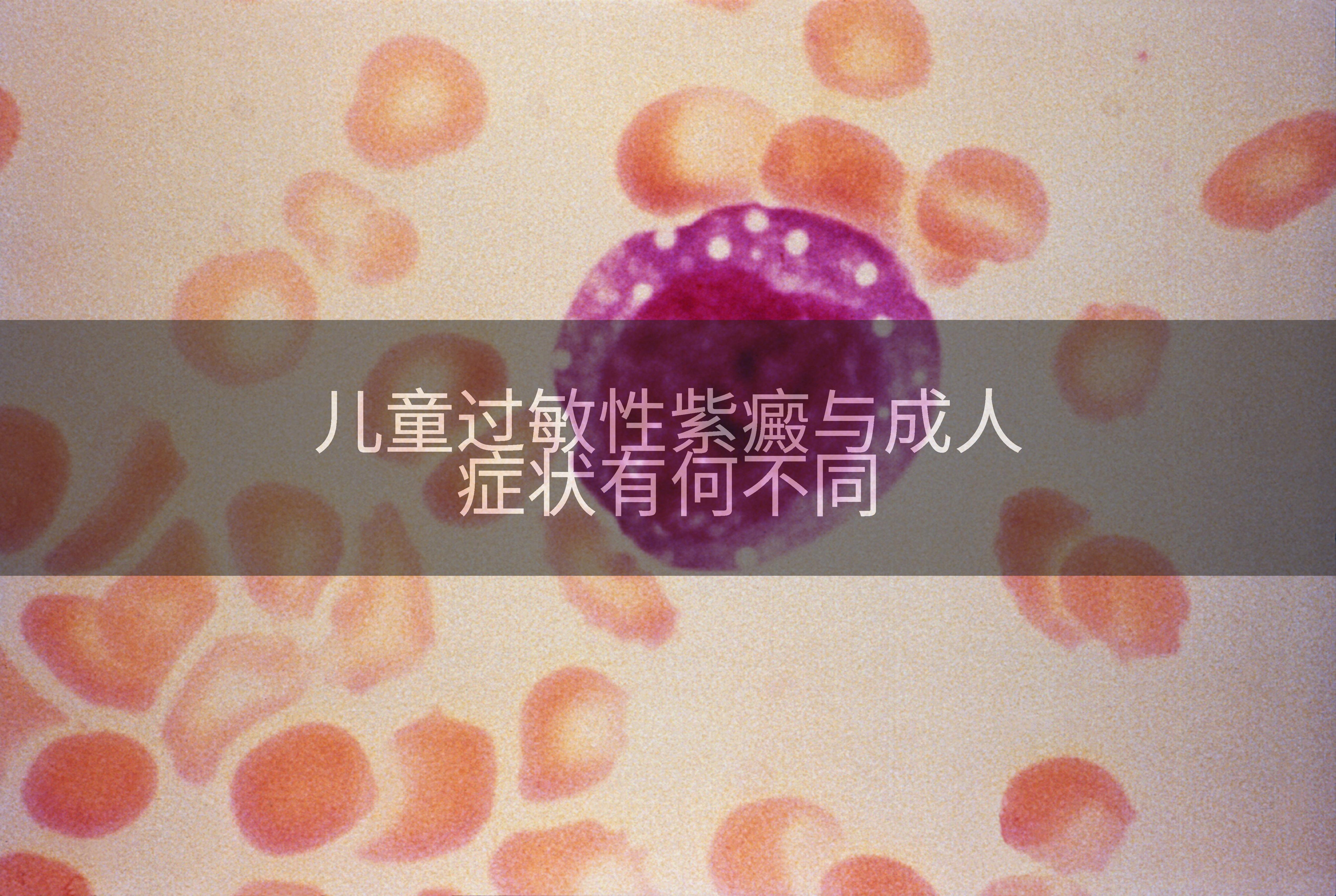 儿童过敏性紫癜与成人症状有何不同