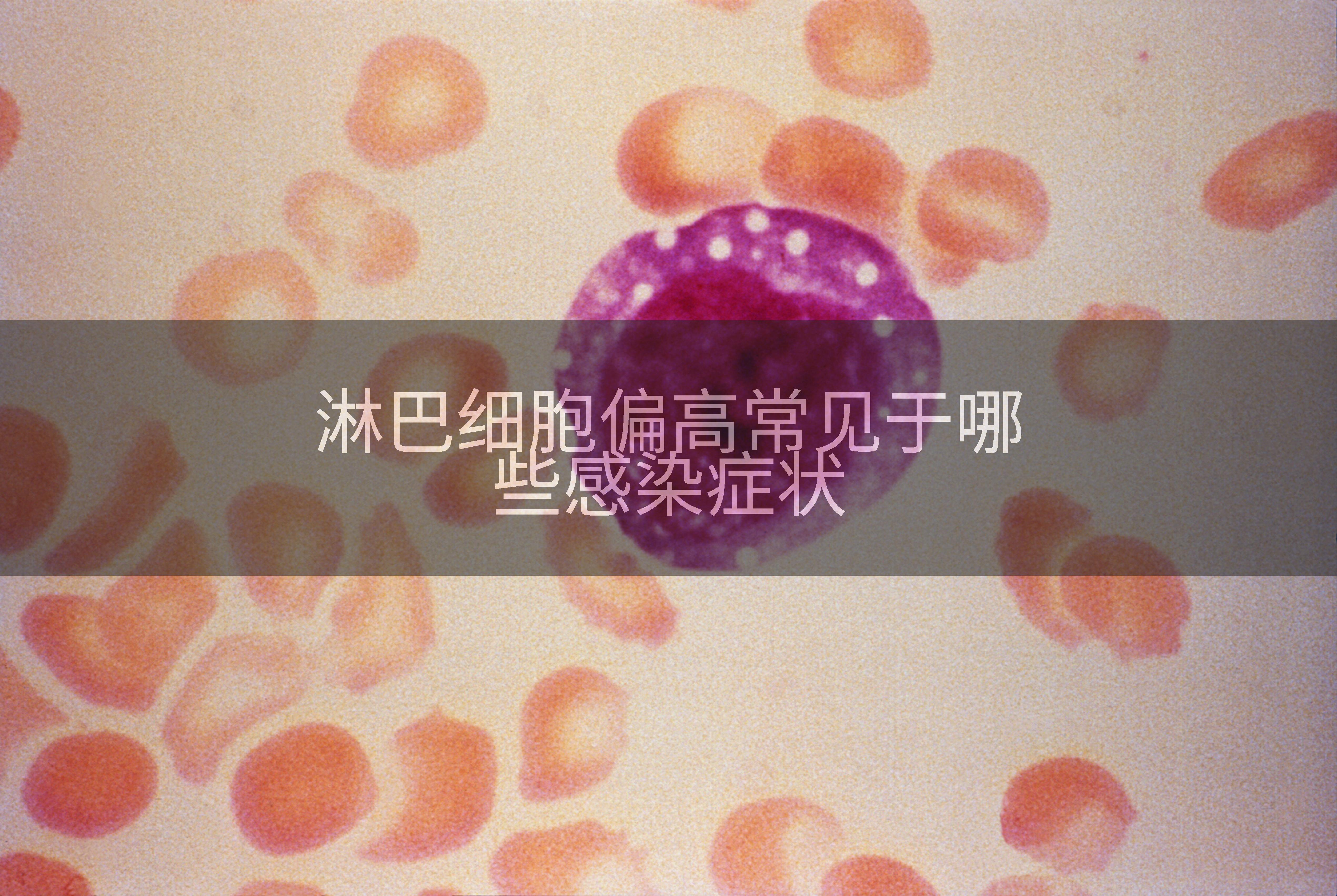 淋巴细胞偏高常见于哪些感染症状
