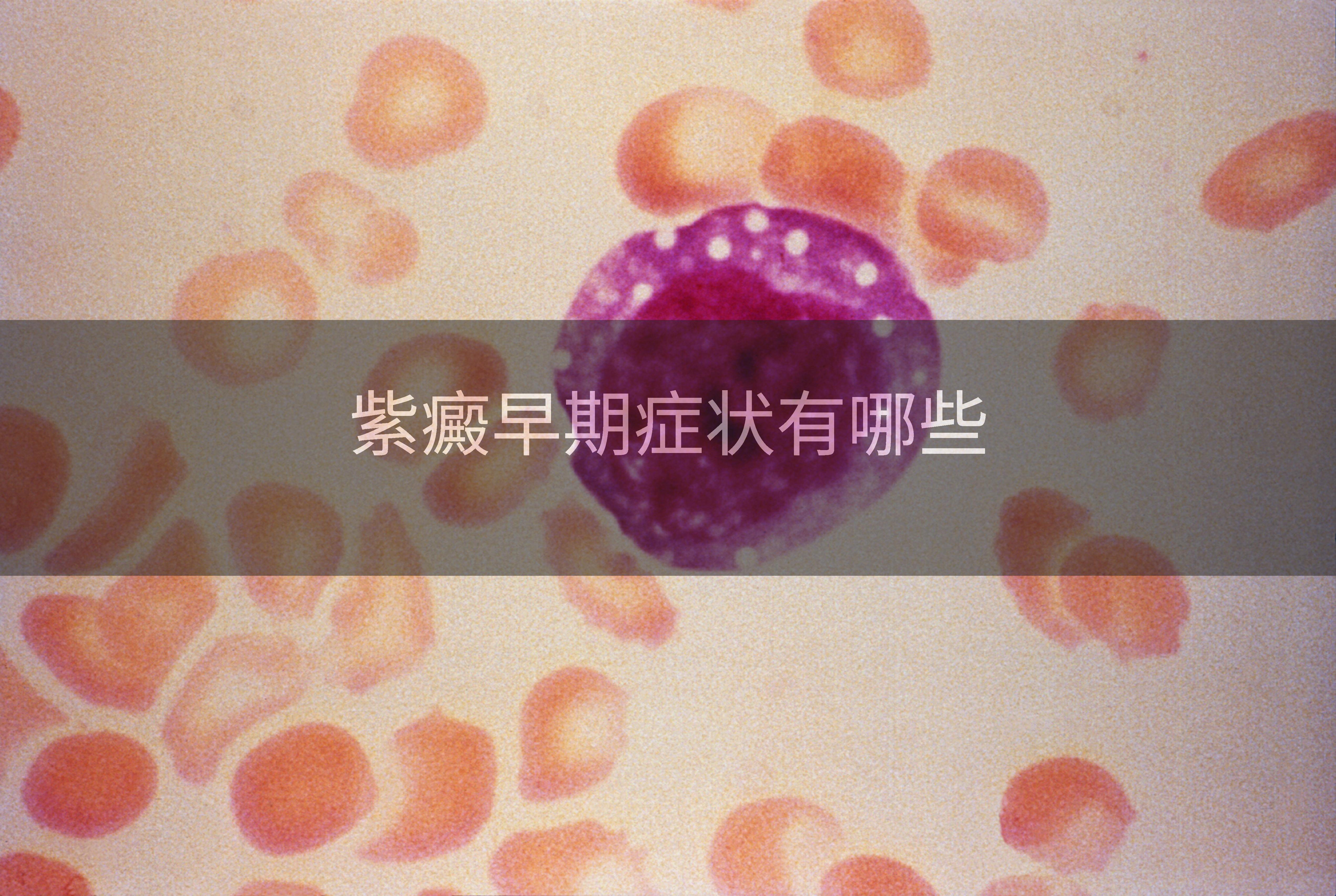 紫癜早期症状有哪些