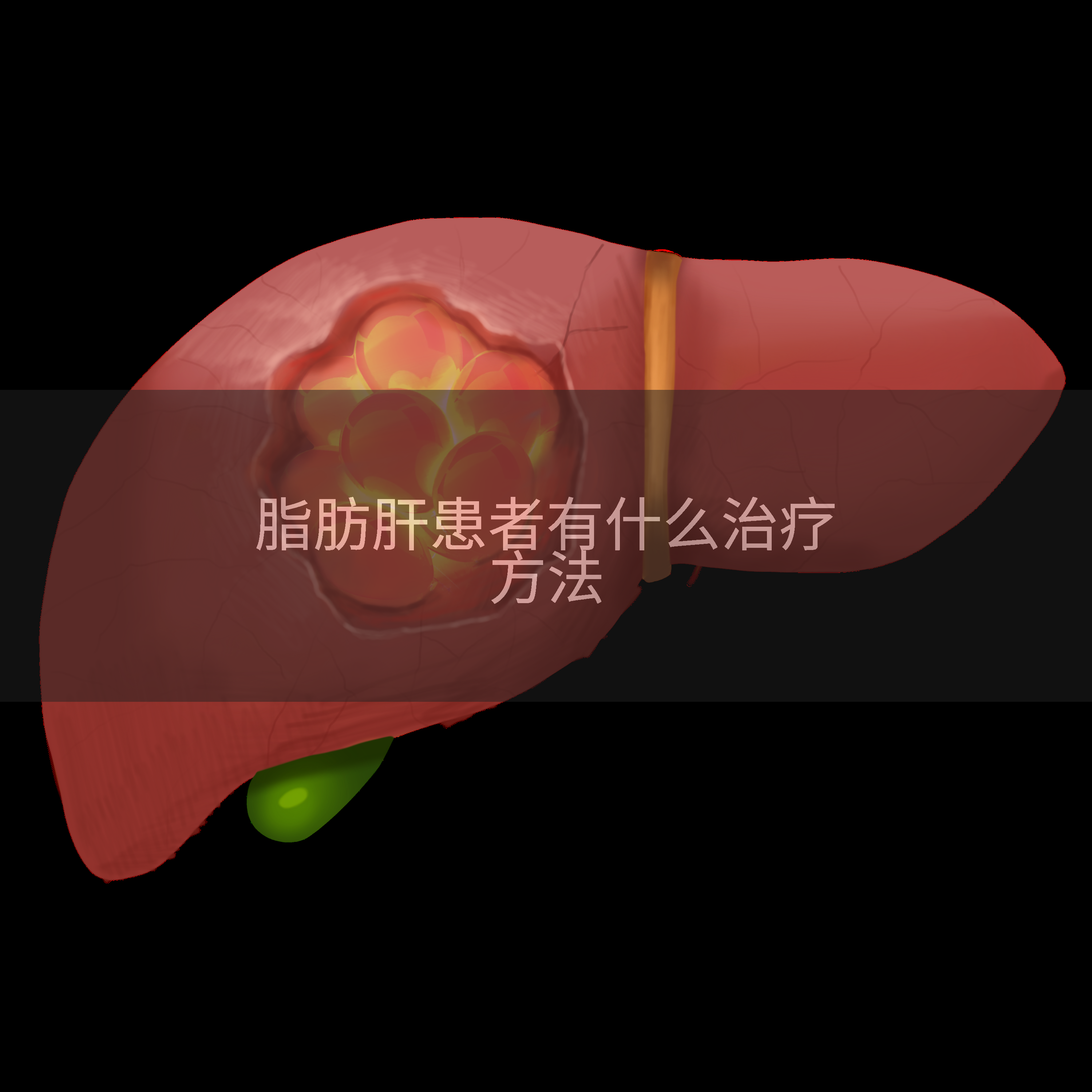 脂肪肝患者有什么治疗方法