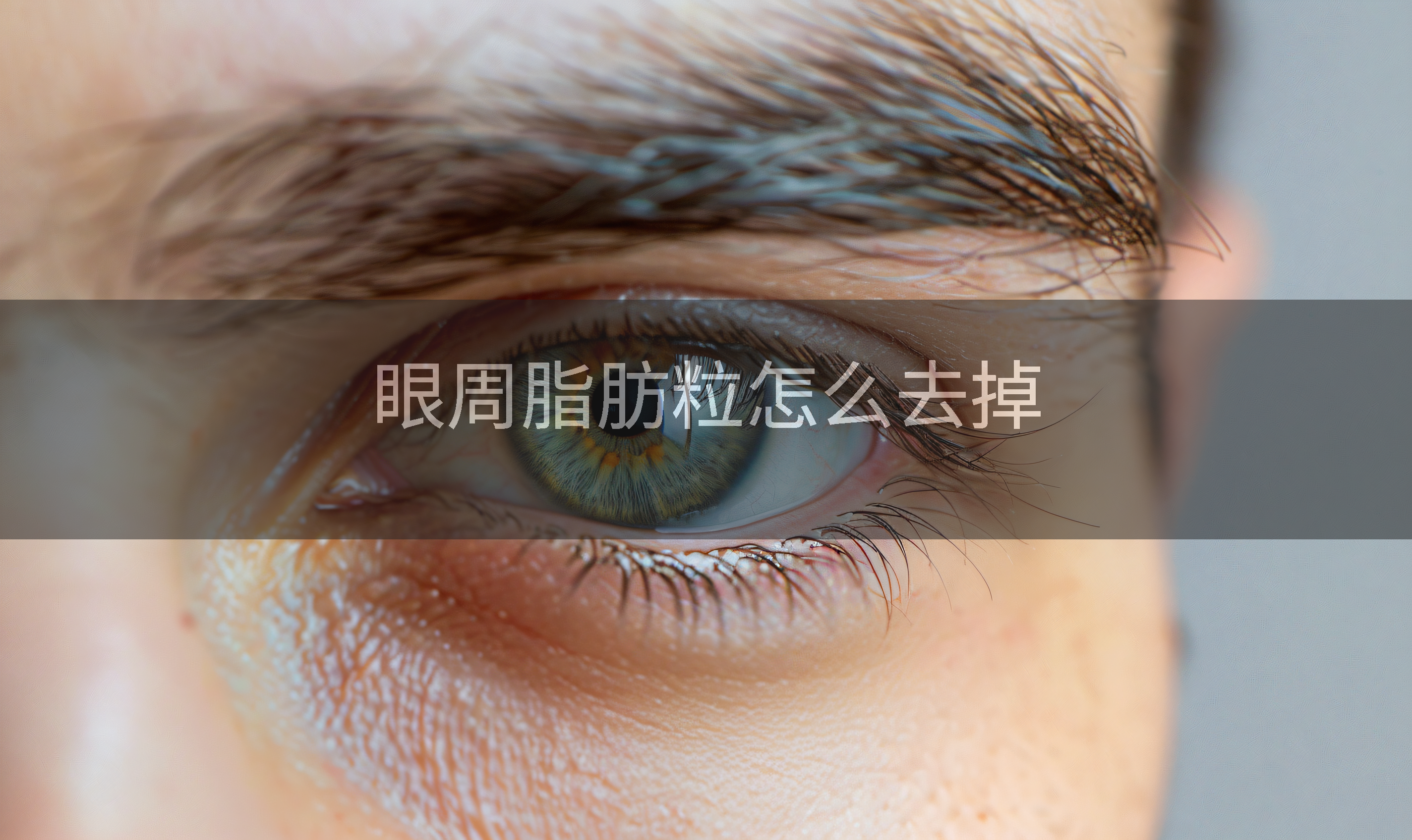 眼周脂肪粒怎么去掉