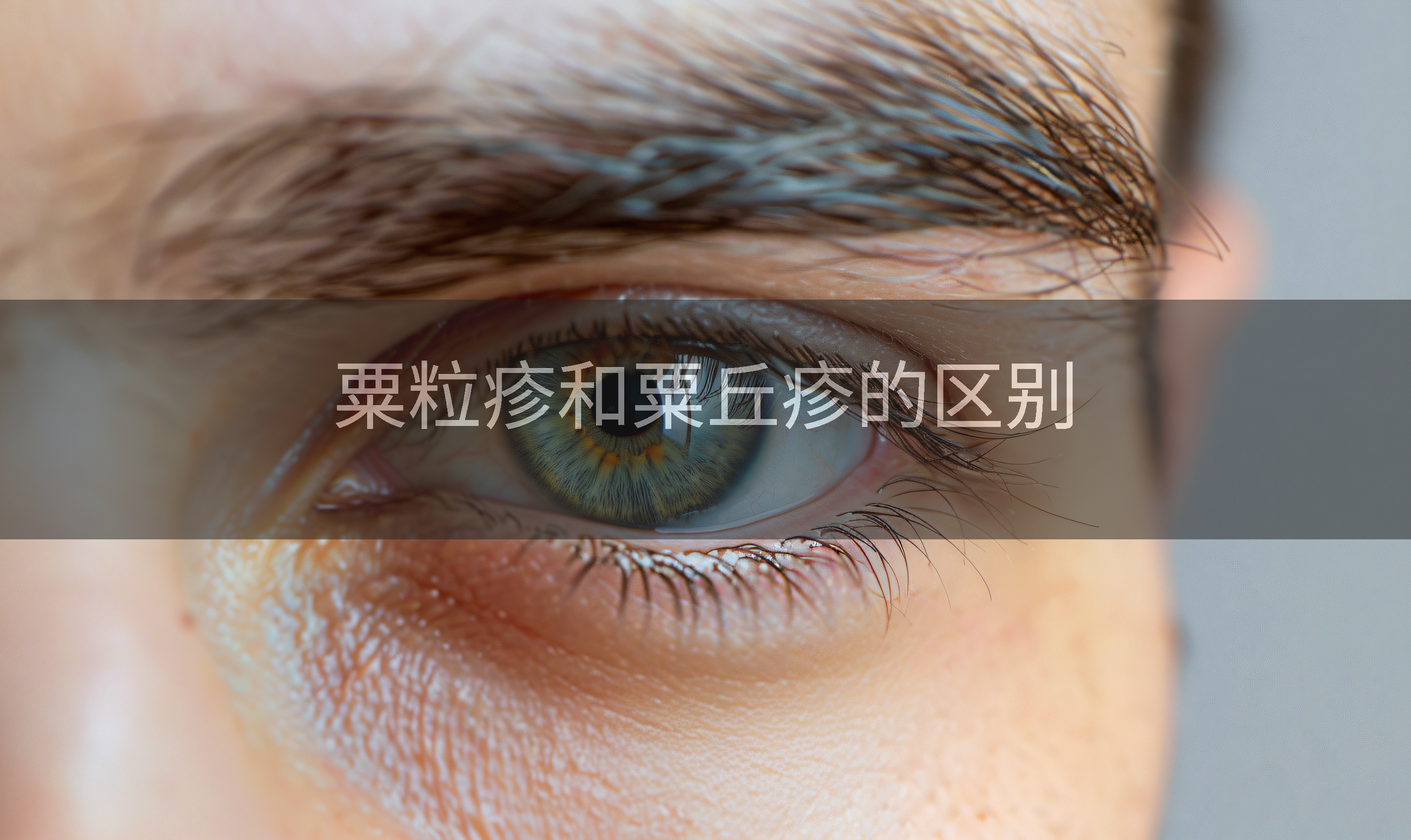 粟粒疹和粟丘疹的区别