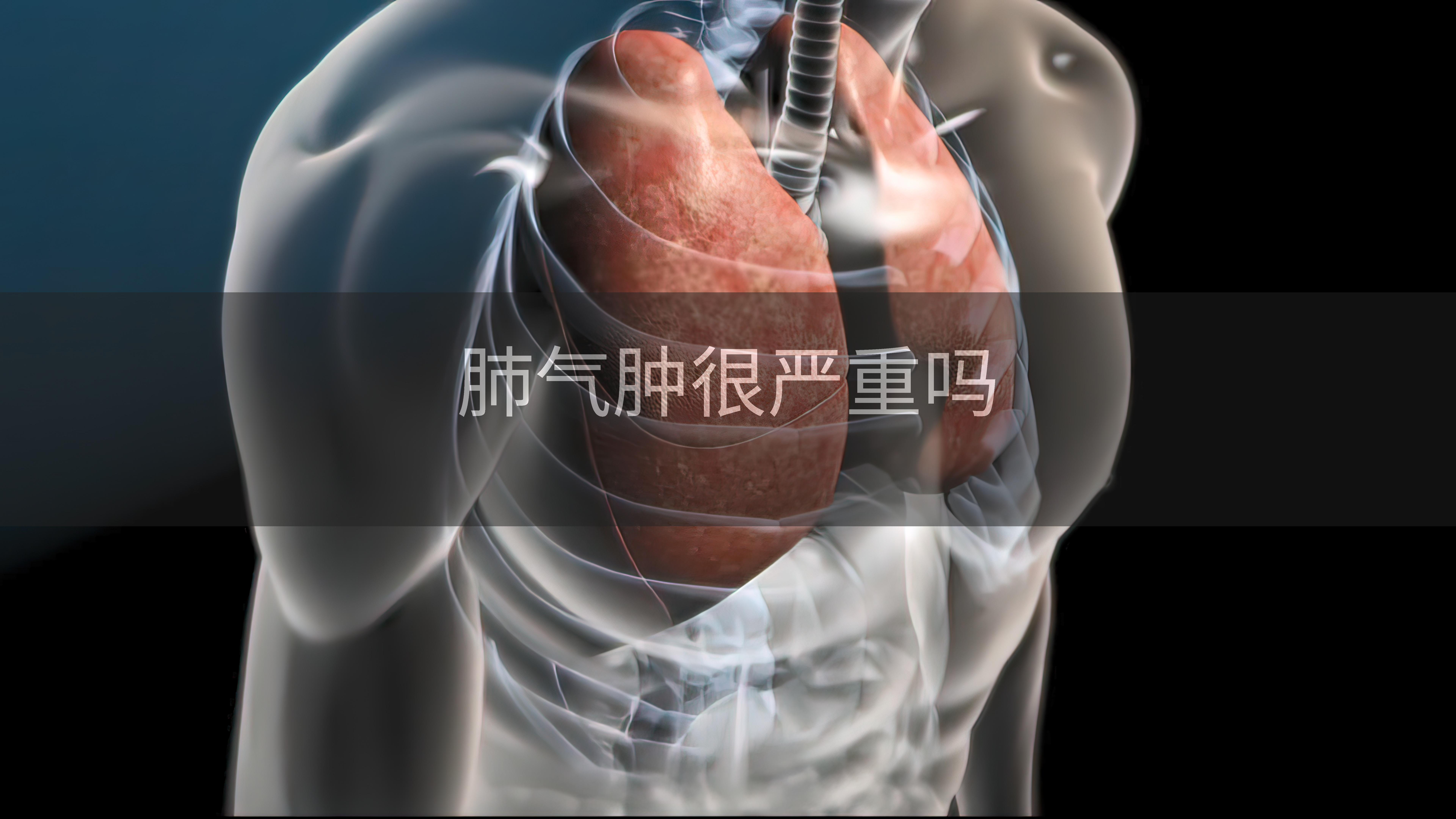 肺气肿很严重吗