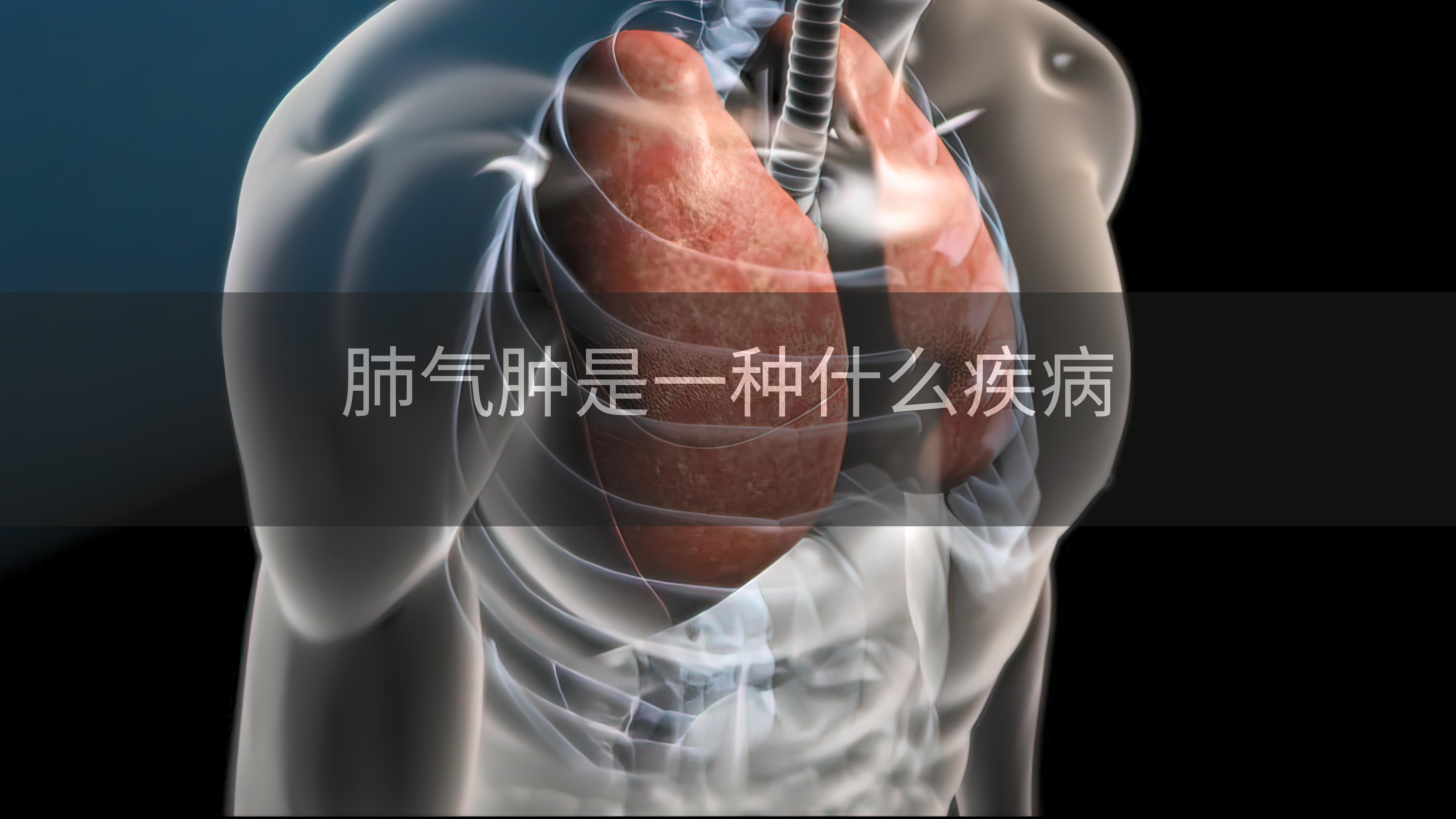 肺气肿是一种什么疾病