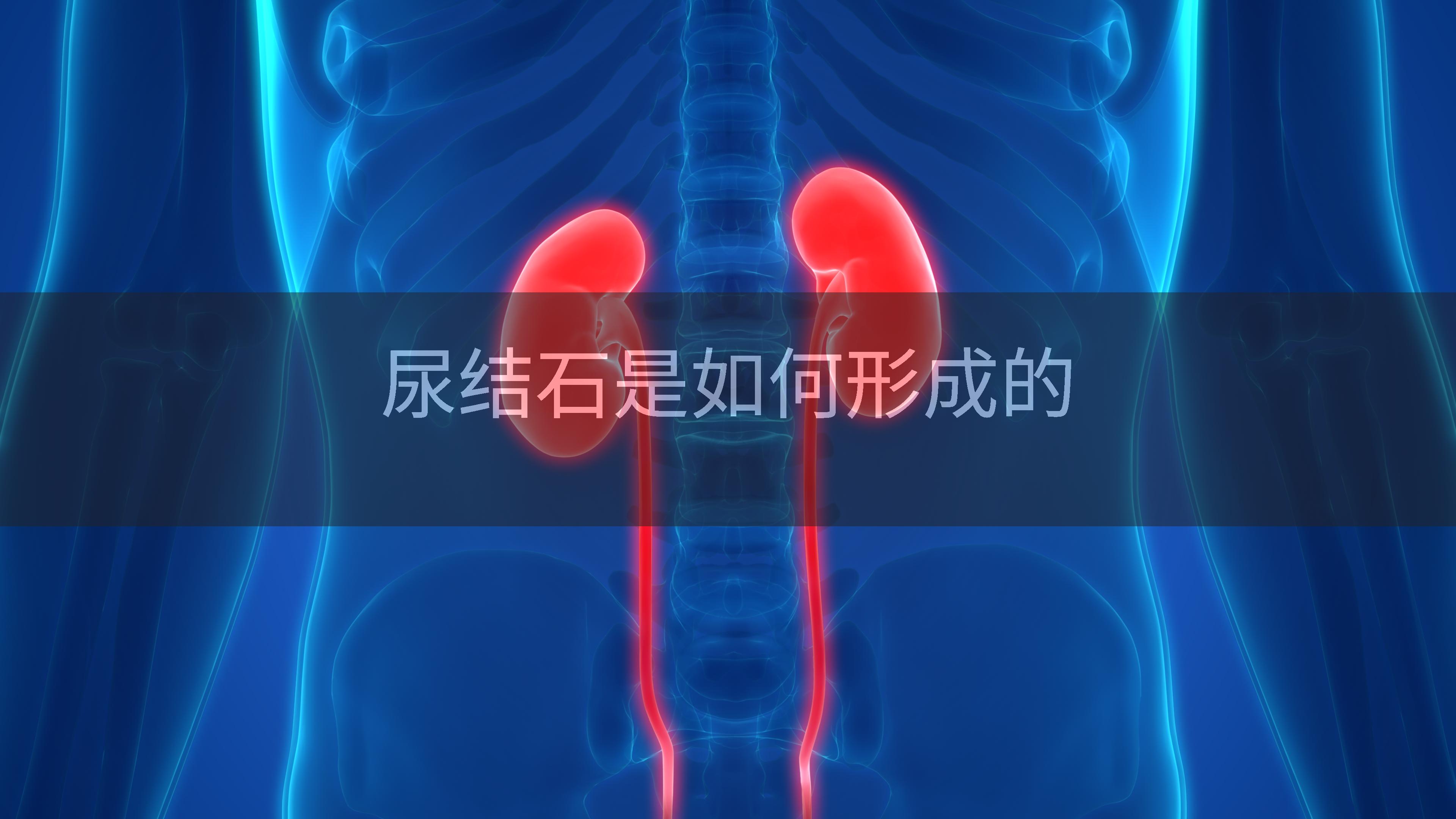 尿结石是如何形成的
