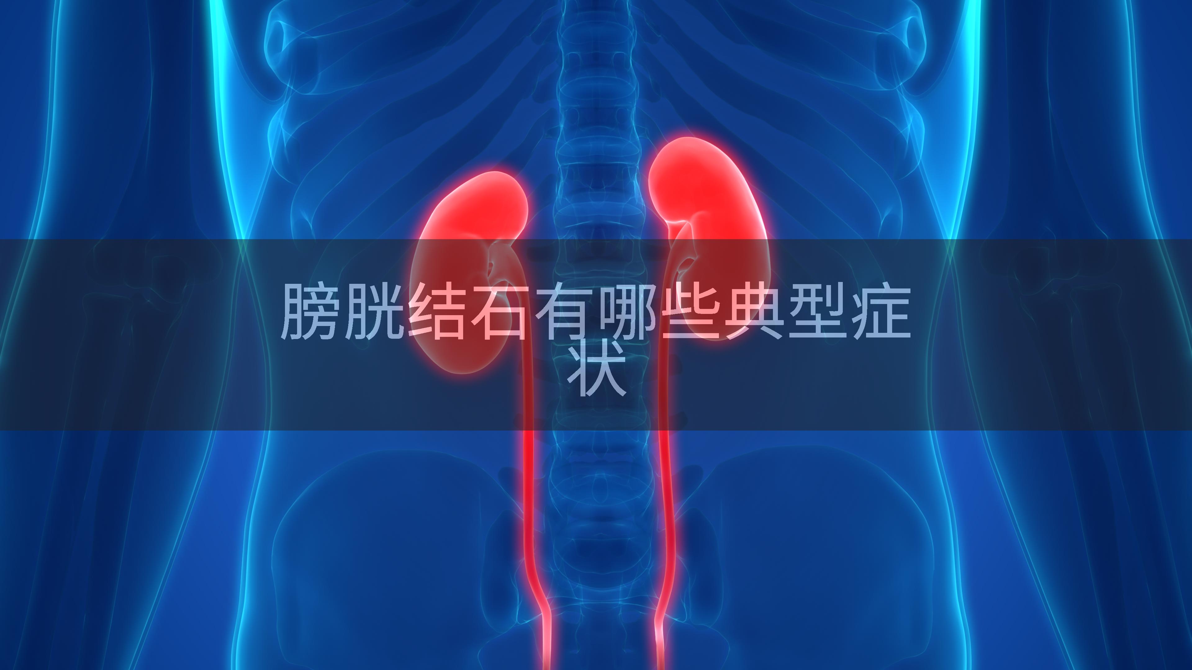 膀胱结石有哪些典型症状