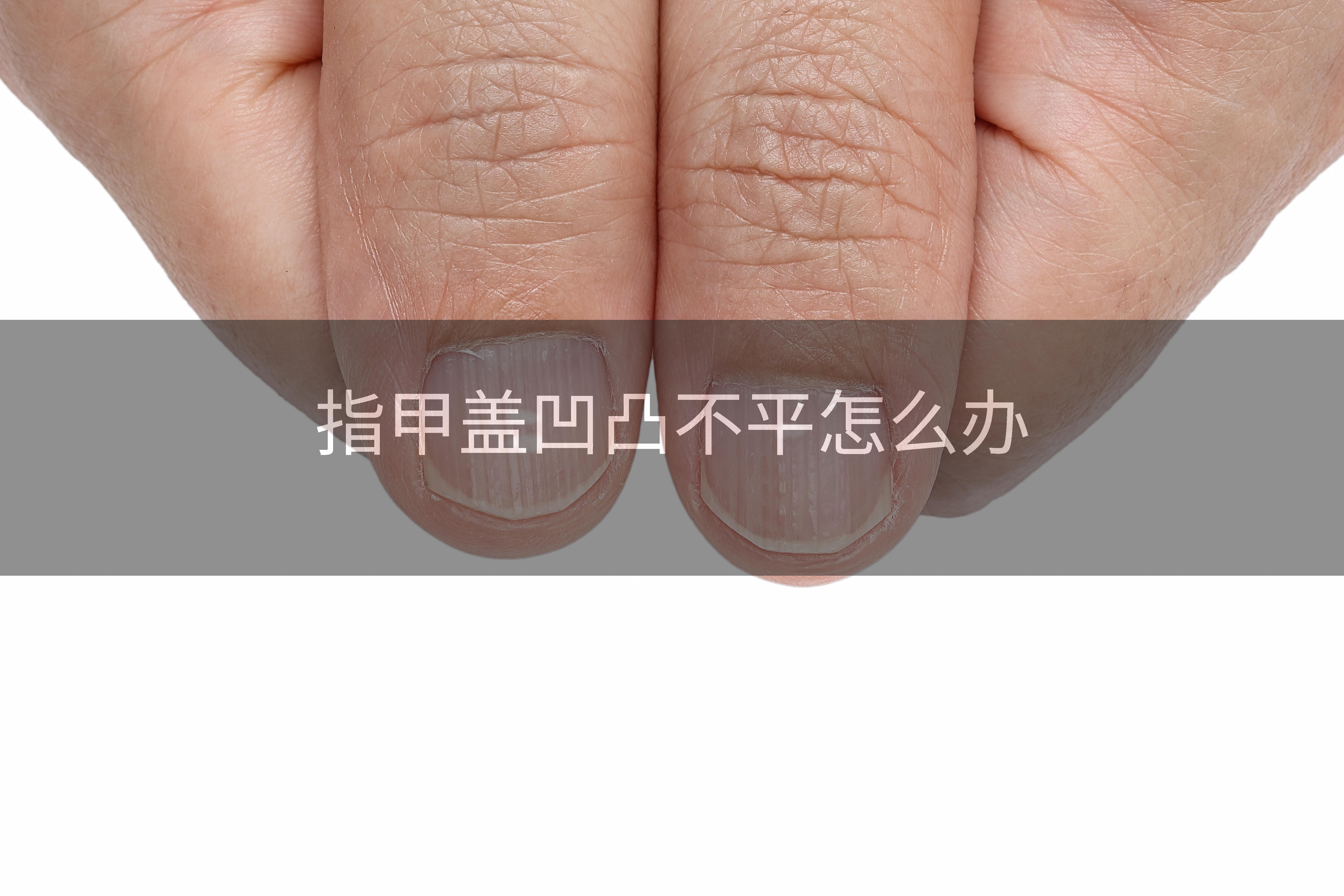 指甲盖凹凸不平怎么办