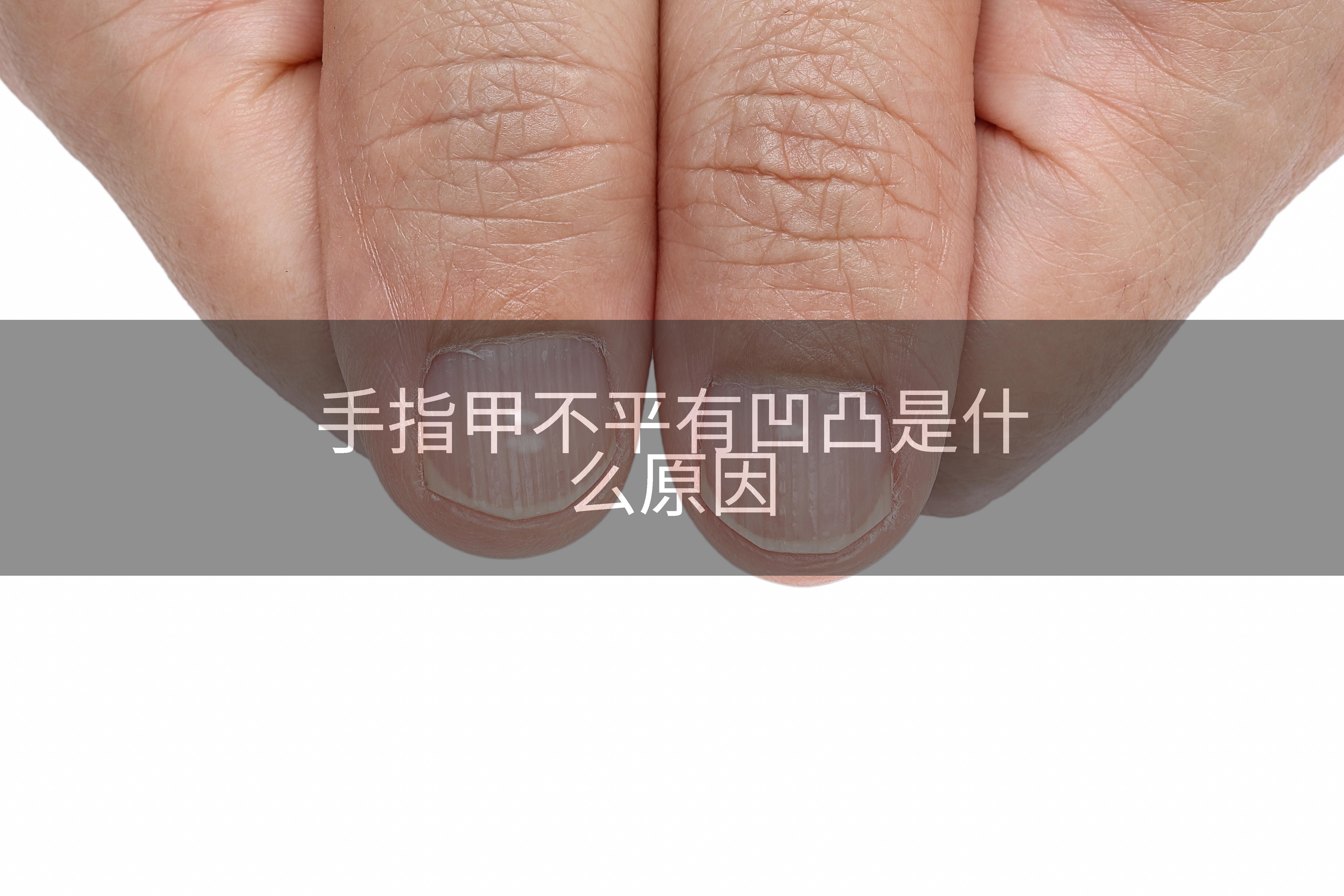 手指甲不平有凹凸是什么原因