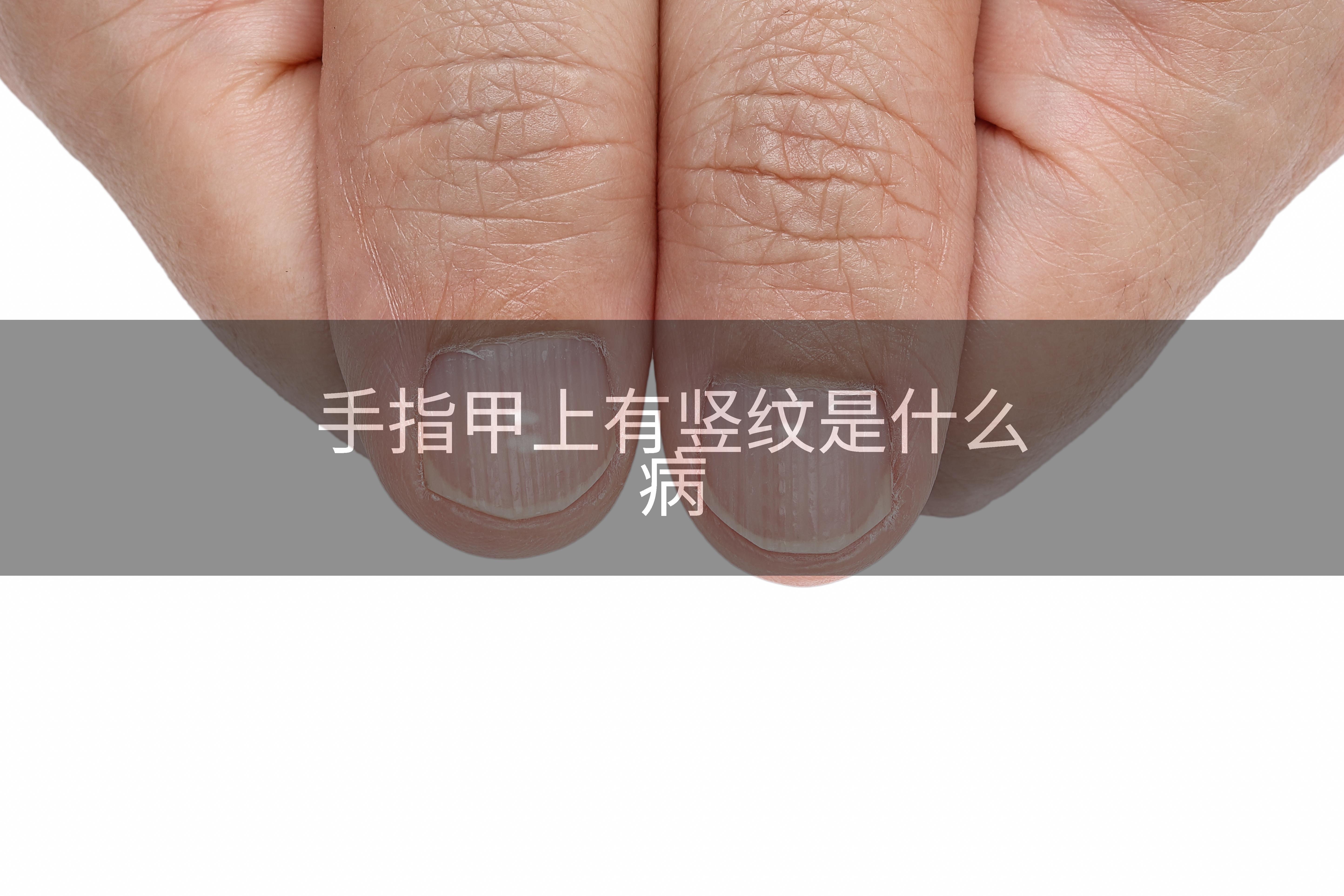 手指甲上有竖纹是什么病
