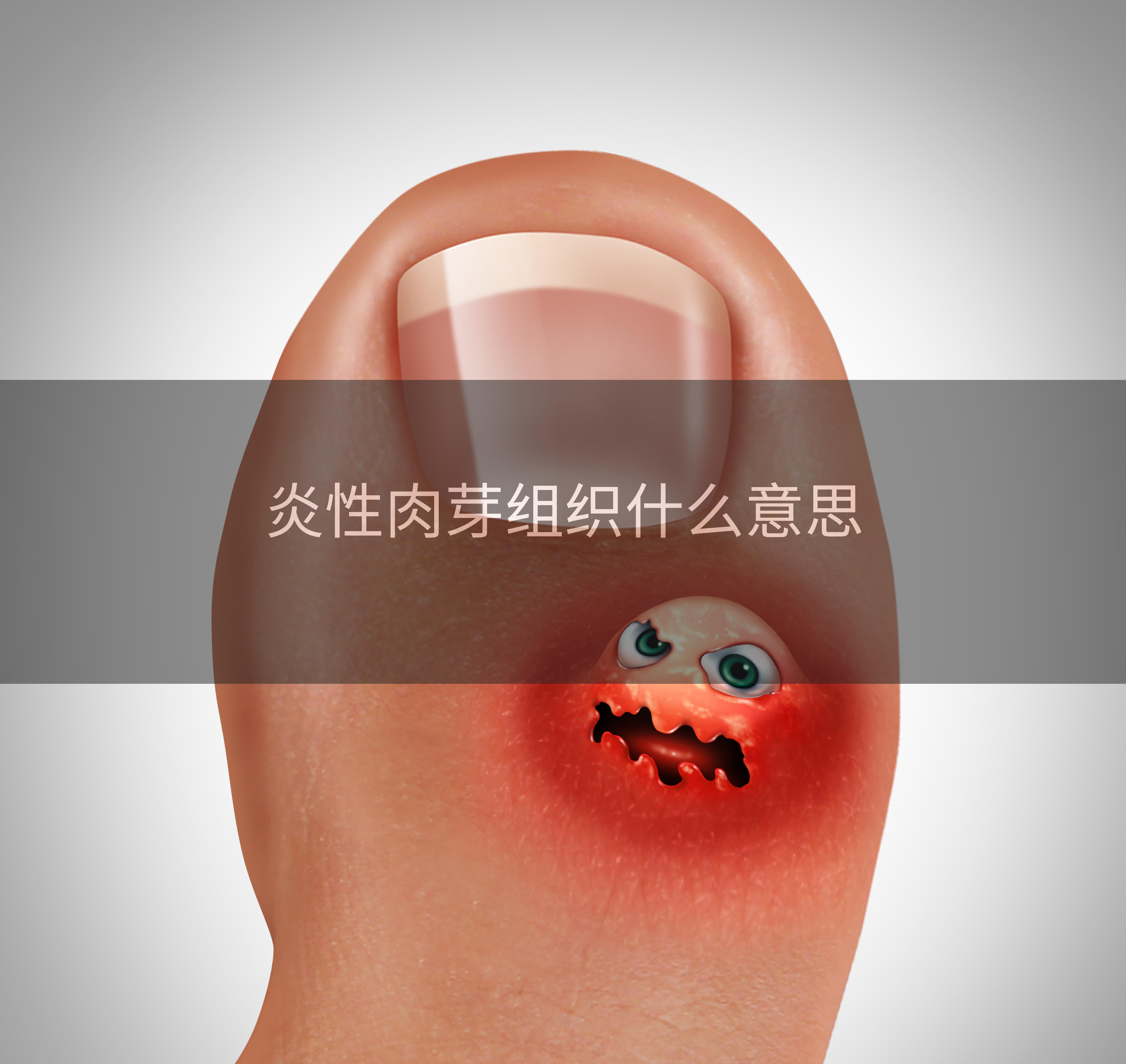 炎性肉芽组织什么意思