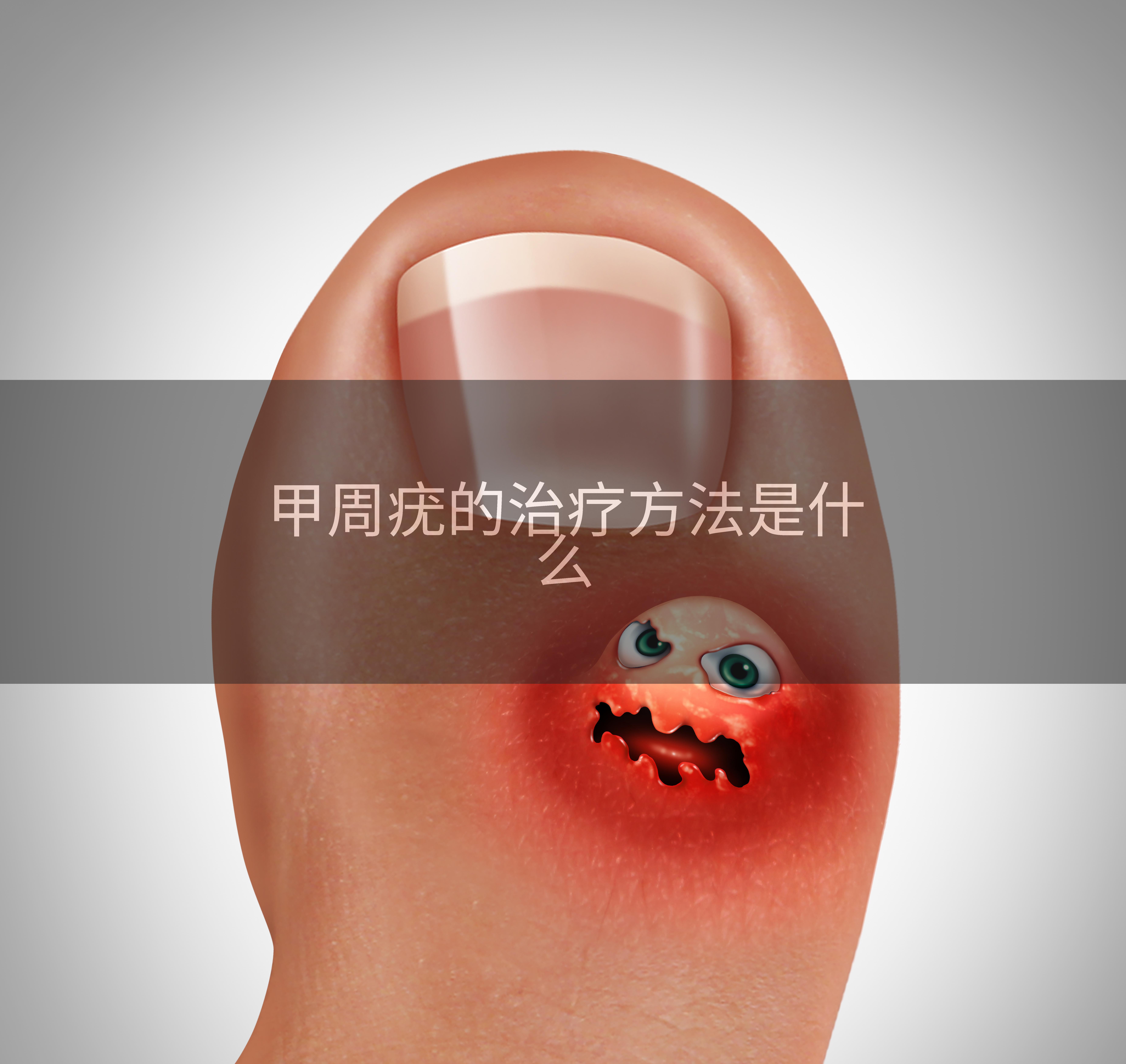 甲周疣的治疗方法是什么