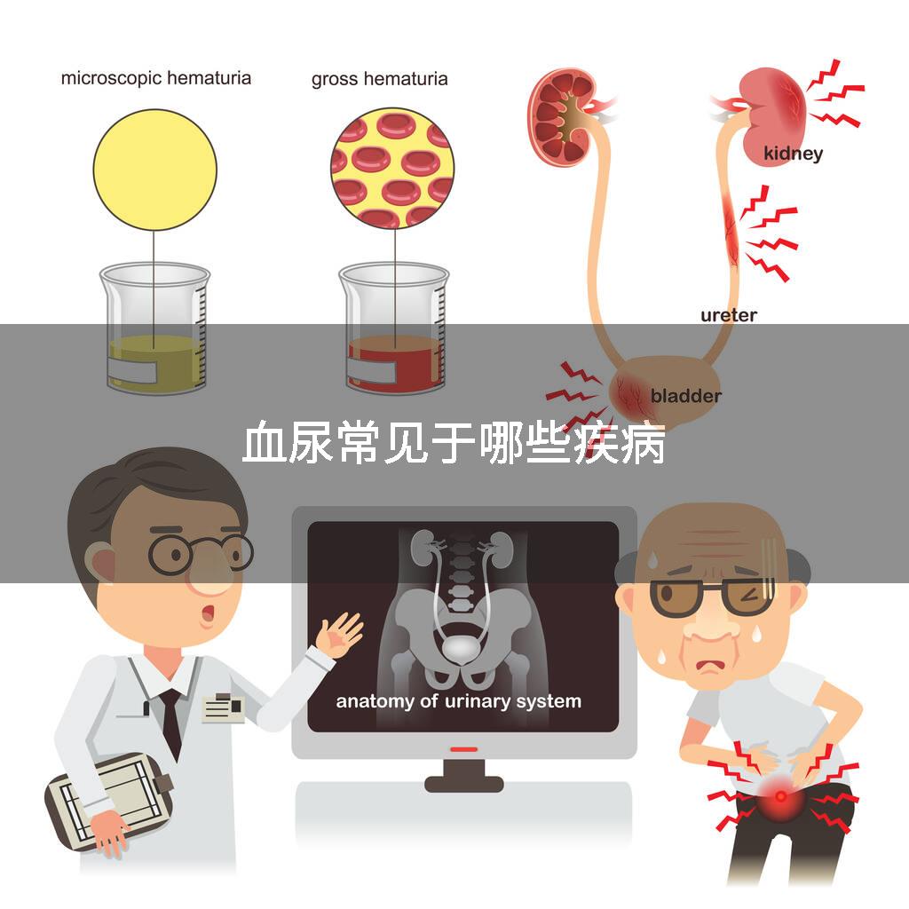 血尿常见于哪些疾病