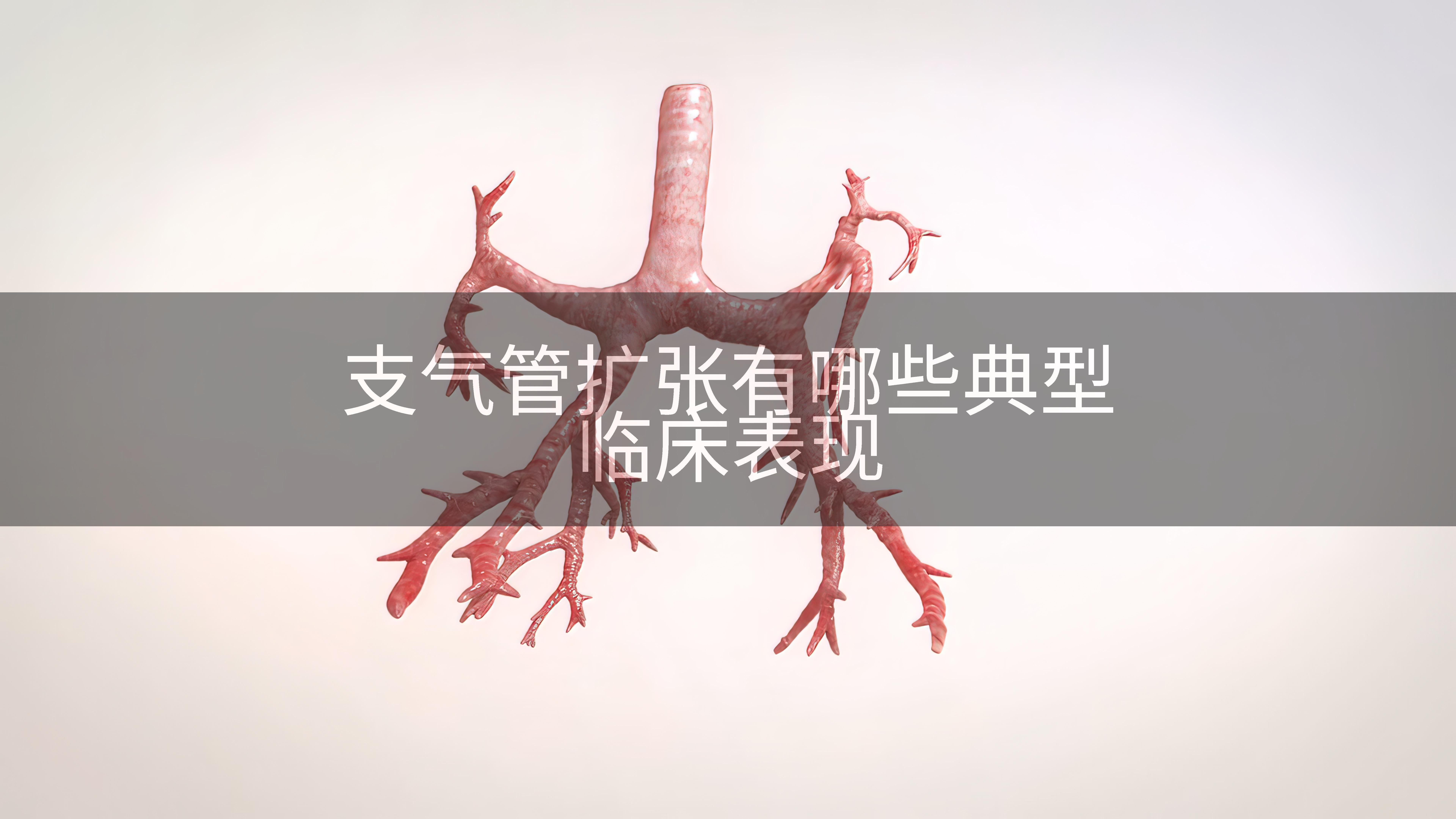 支气管扩张有哪些典型临床表现